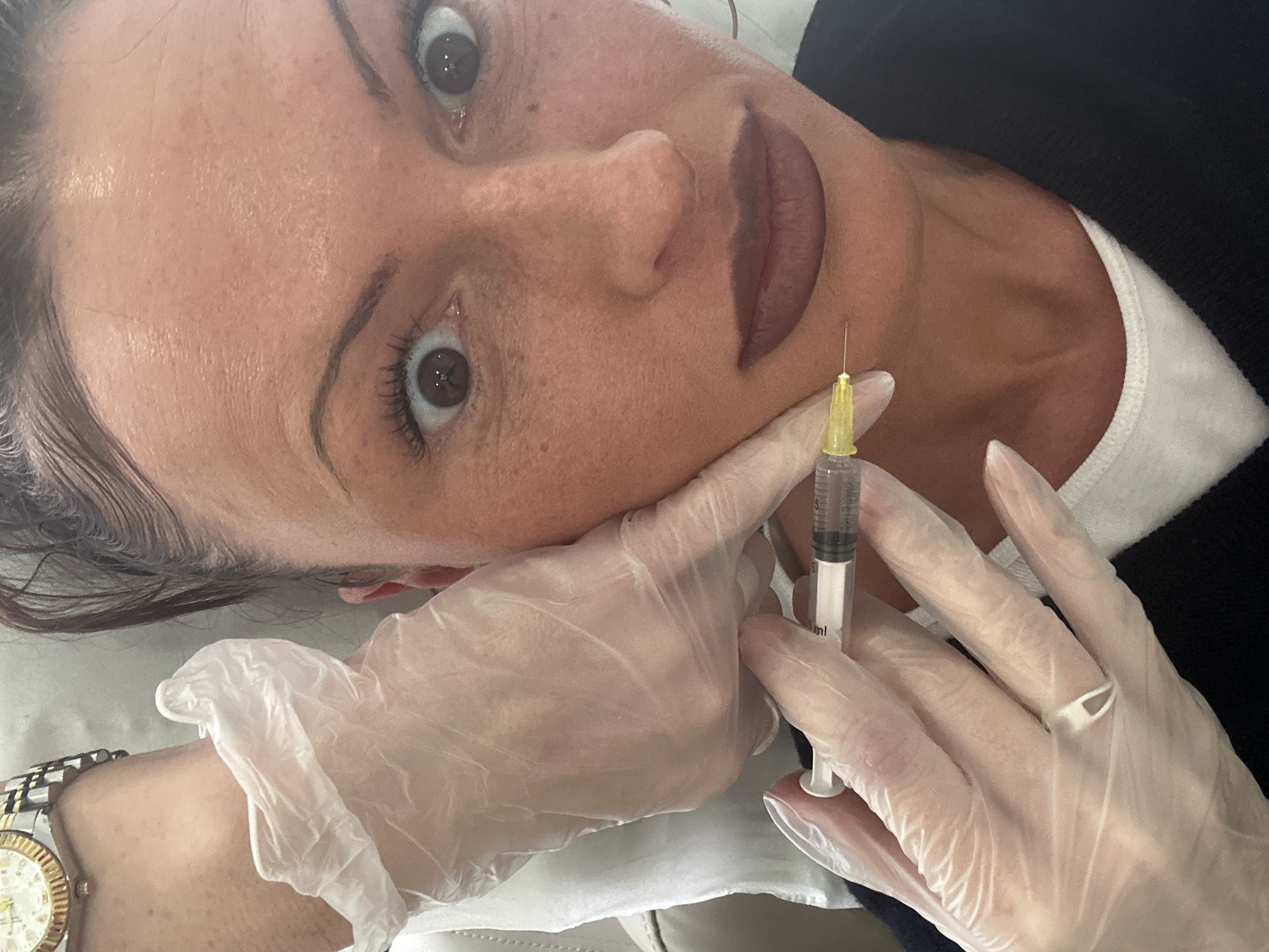 A woman lies on her back receiving an injection in her cheek. She wears dark eyeliner and lipstick. A gloved hand holds her cheek taut while the other holds a syringe with a yellow needle poised to inject. A watch is visible on the injector's wrist. A white t-shirt is partially visible beneath the black clothing. The environment appears to be a clinical setting. There is no indication of the location being in London, United Kingdom.