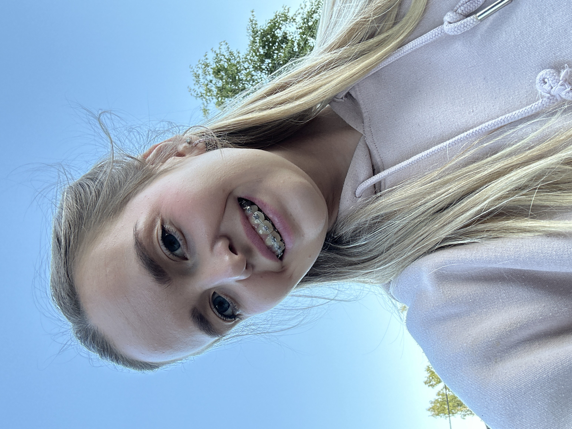 The media file is a close-up, low-angle selfie of a young person with blonde hair against a bright blue sky and some green trees in the background. The subject is wearing a light purple hooded sweatshirt. They have braces on their teeth, which are visible as they smile. The image is slightly tilted, and the subject's face is looking up towards the camera. The lighting suggests it is daytime, likely sunny. The location context provided is Азинский, Russia.