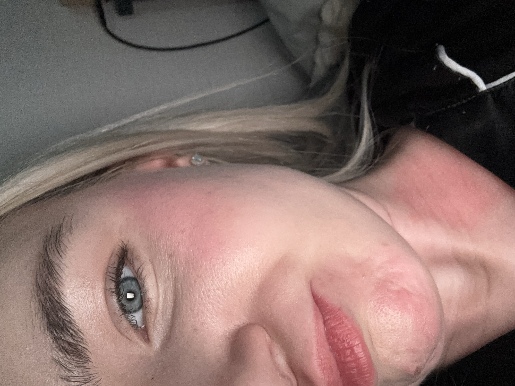 This close-up portrait, captured in Vsevolozhsk, Russia, features a person, likely female, with fair skin, light blonde hair, and striking light blue eyes. The image is oriented vertically, showing the subject's face from the left eye, nose, and mouth, extending to a portion of the neck and shoulder on the right.
The individual gazes directly into the camera with a neutral expression. Prominent features include a well-defined eyebrow, natural skin texture with visible pores, and full lips with a reddish hue. There is a noticeable flush or redness on the cheeks, chin, and neck. A small, sparkling earring is visible in the earlobe.
The subject wears a dark, possibly black, garment, from which a white cord or string emerges on the right side of the frame. The background is blurred and indistinct, revealing a greyish surface, perhaps a wall or bedding, and faint dark lines that resemble cables or wires. The lighting is soft and appears subdued, indicating an indoor setting, possibly in the evening or a dimly lit room. No text is visible in the image.