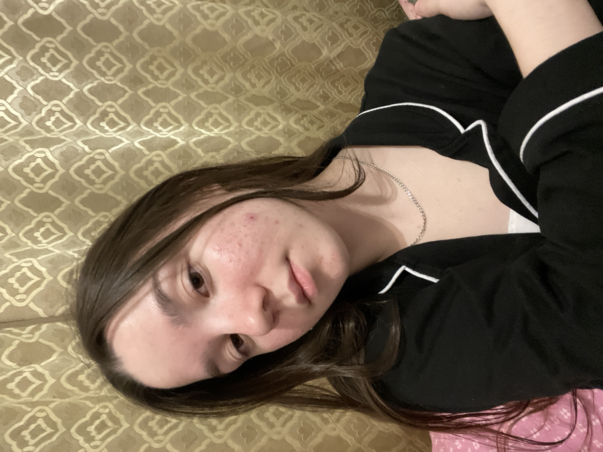 A young female is depicted in a close-up, indoor setting within the city of Ольховка, Russia. She possesses long, dark brown hair and fair skin, exhibiting visible redness and acne on her cheeks and forehead. Her dark brown eyes are directed towards the viewer. She is wearing a black long-sleeved top, likely pajamas, featuring white piping along the collar and cuffs. A thin silver chain necklace is visible around her neck. Her right arm is bent and positioned across her chest, with her left arm partially obscured beneath it. The background consists of a golden-colored fabric, identified as a curtain, displaying a repeating patterned motif resembling stylized diamonds or ogee shapes. A pink fabric with a subtle white pattern, possibly a pillow or blanket, is visible in the lower left of the frame. The lighting indicates an internal, artificially lit environment.