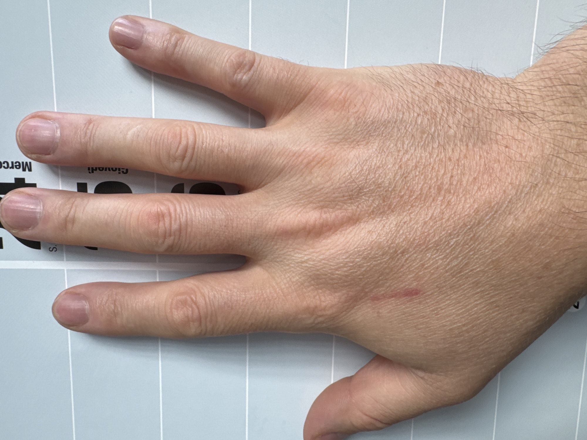 An overhead view shows a person's left hand and forearm resting on a light blue surface with thin white horizontal lines. The hand is open with the palm facing upwards and the fingers spread. The nails appear clean and unpolished. A small, reddish mark, possibly a scratch or abrasion, is visible on the lower part of the palm. The surface beneath the hand displays faint text in black, including the word "Mercedi" vertically oriented on the right side. This text suggests the surface is part of a calendar or planner. The image does not provide any information about the city of Mejaniga, Italy.