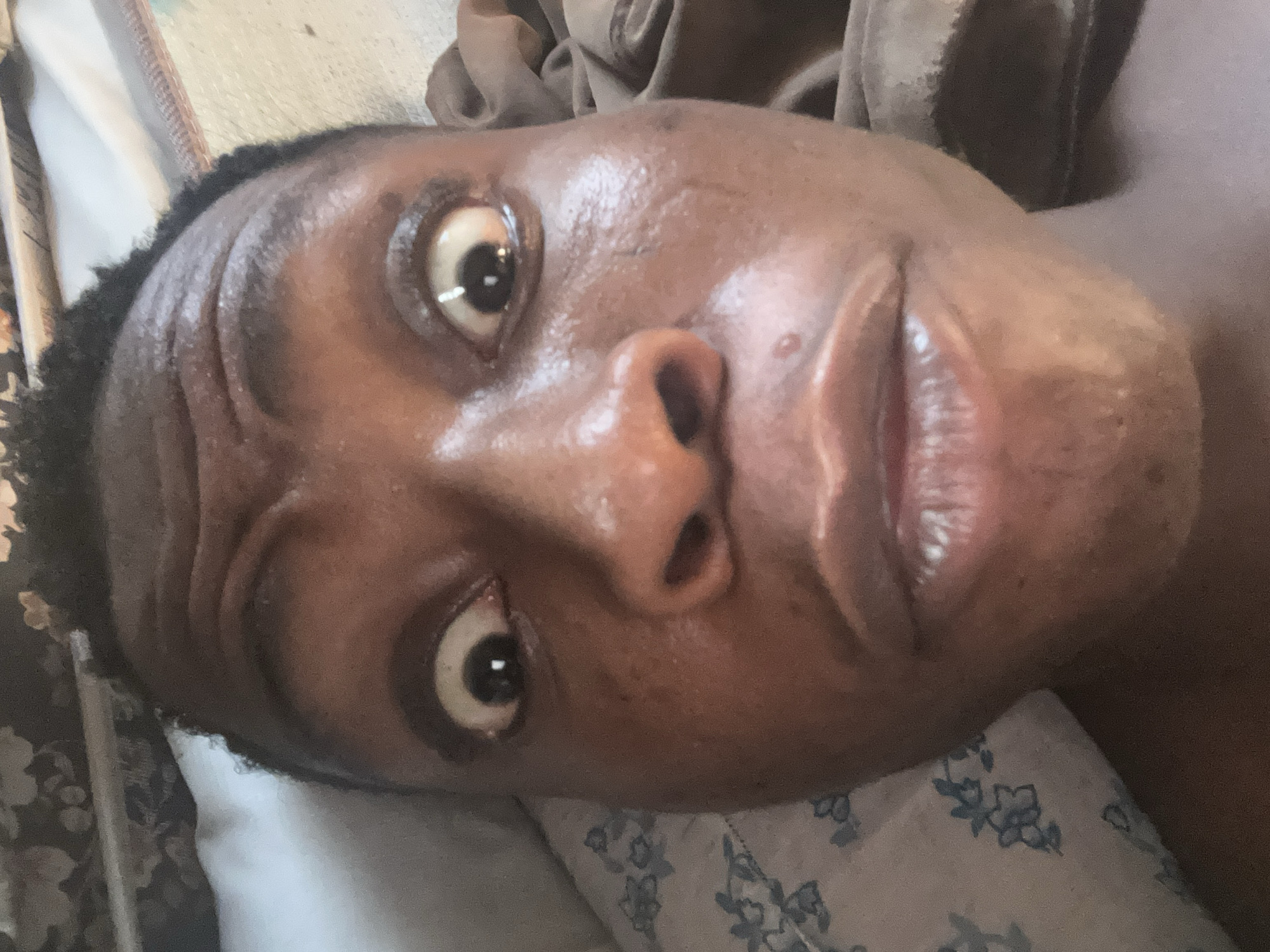 A close-up, tilted, eye-level shot features a dark-skinned person lying on a pillow with a floral pattern. The person's face is the primary focus, with their eyes wide and slightly dilated, suggesting alertness or surprise. Forehead wrinkles are visible. The skin appears to be moist or oily. The background consists of neutral-toned bedding and fabric, adding to the close and intimate feel of the shot. There is no visible information suggesting the city is Unknown, Unknown.