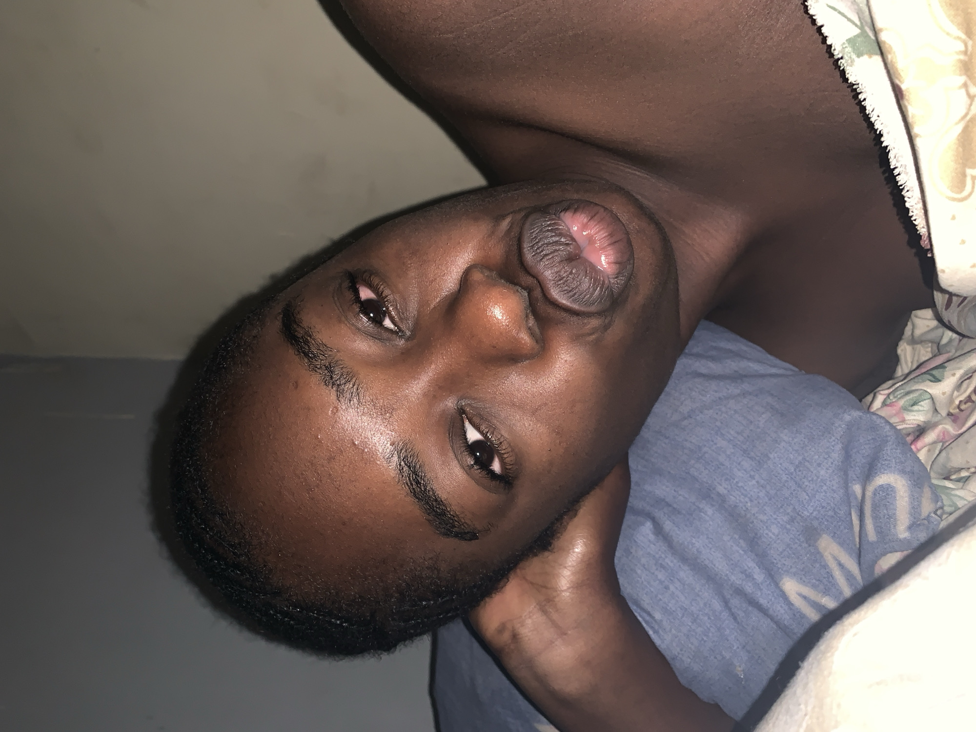 The image, taken in Rafin Par, Nigeria, features a person with dark skin lying down, likely on a bed indoors, with their head tilted and face looking towards the camera. The subject's mouth is puckered into a prominent, circular shape, revealing the inner lip tissue. Both eyes are open, with the right eye (viewer's left) fully visible.
The person has short, dark hair and noticeable facial hair along the chin and jawline. Their skin has a slight sheen, possibly due to natural oils or warmth. They appear bare-chested, with part of their upper body visible, showing dark skin texture.
The setting is dimly lit, suggesting low light conditions such as night or early morning, or a room with minimal illumination. A blue pillow, with some indistinct light-colored text (possibly an 'M' and 'A'), is visible beneath the person's head. Part of a patterned blanket, cream and white with floral or abstract designs, can be seen on the right side of the frame, covering a portion of the body. The background is a plain, dark gray wall. The overall impression is a candid, unposed moment.