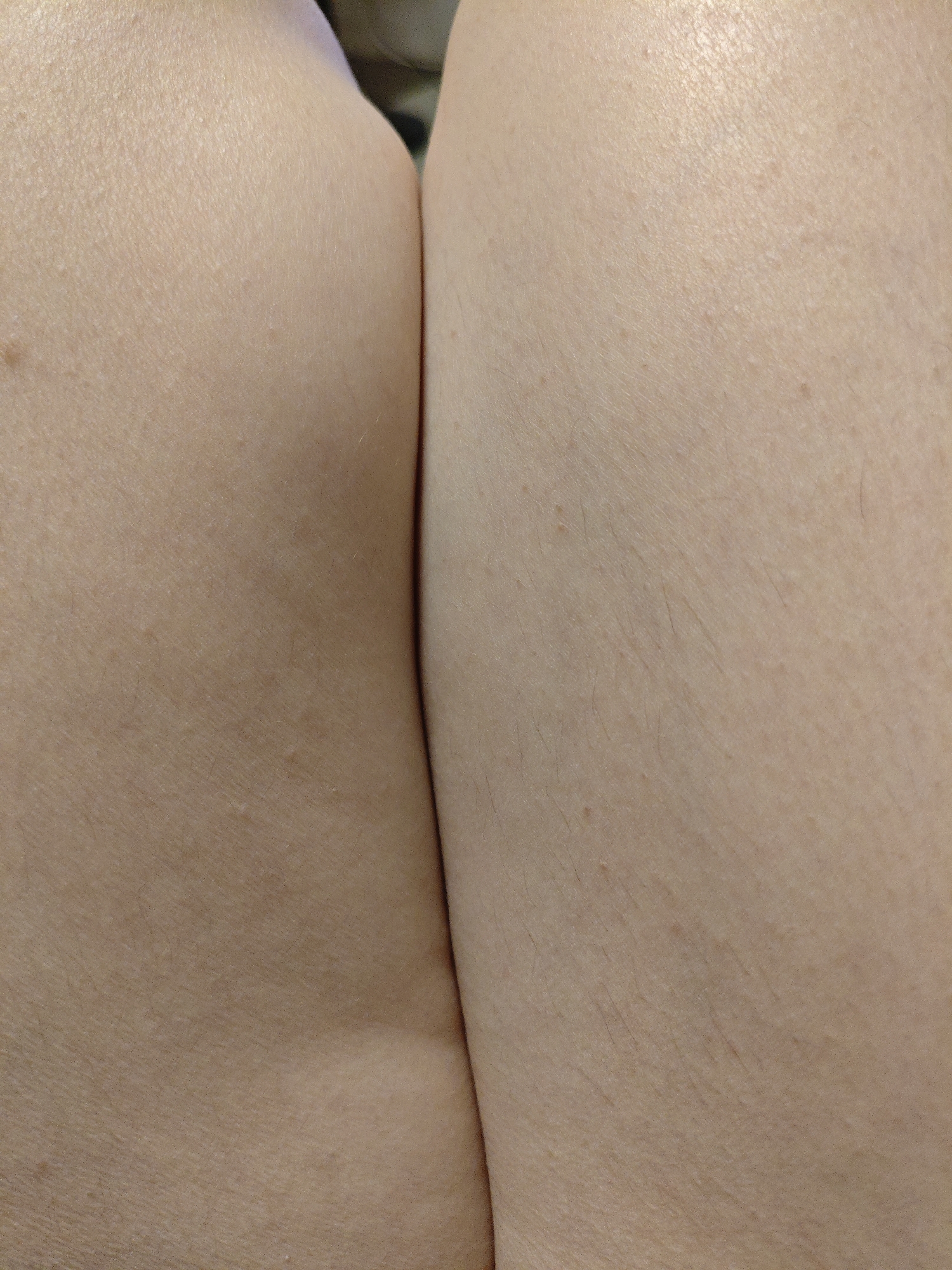 The image is a close-up, low-angle shot of skin, likely a portion of a person's buttocks or upper thighs, seen from behind. The skin is light-toned with visible pores and fine hairs. There are a few small, scattered bumps or moles on the surface. The two areas of skin are pressed together, creating a deep crease or fold between them. The lighting highlights the texture of the skin. There is no indication of the city of Masally, Azerbaijan, or any environmental context beyond the close-up view of the skin.