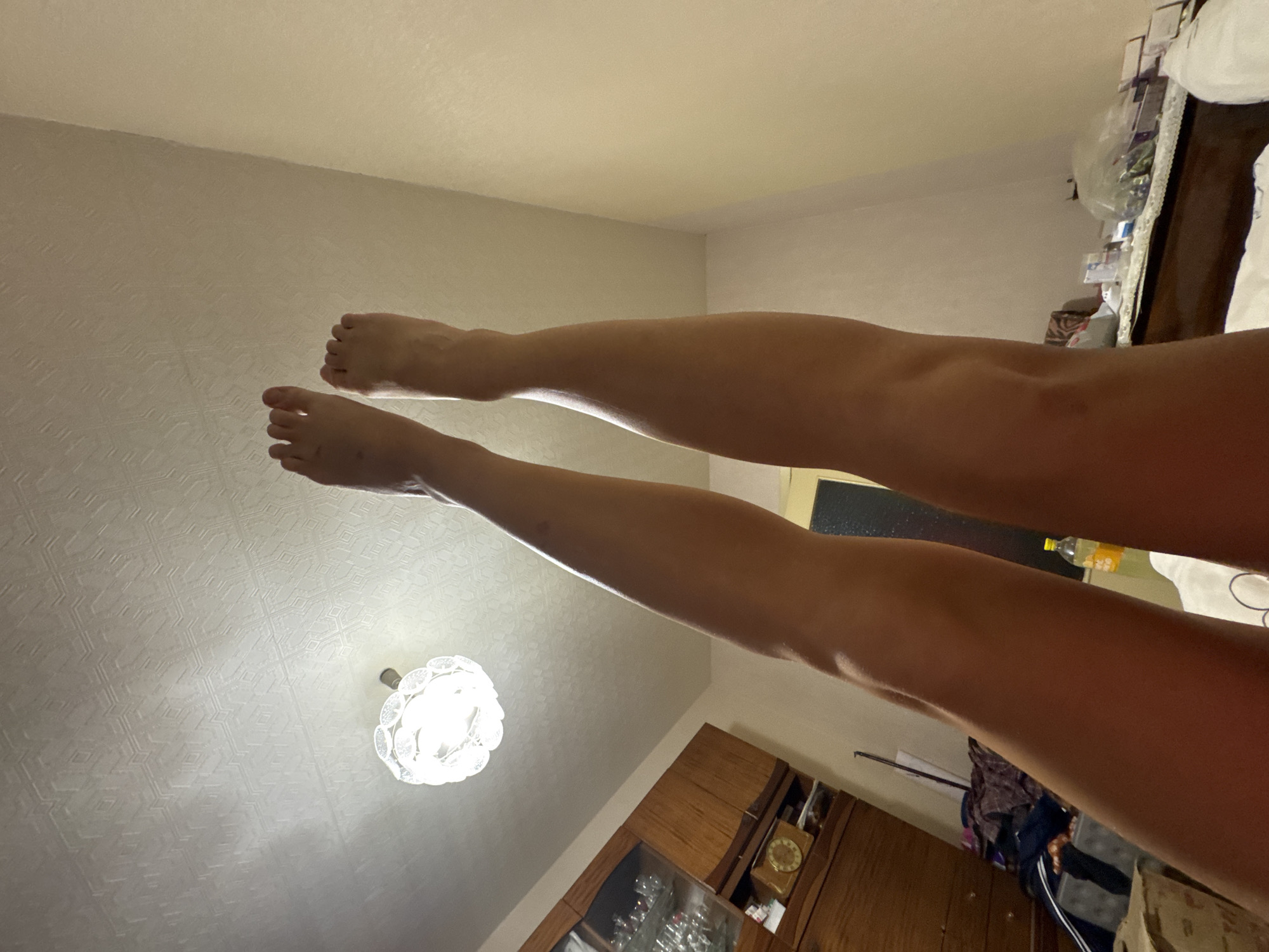 A low-angle interior shot shows two human legs, positioned vertically upwards towards a textured white ceiling. The feet are visible at the top of the frame, toes pointed. Directly below the feet, a white, ornate ceiling light fixture is illuminated. The legs are bare and tanned, with some minor marks visible on the skin.
To the left of the image, a wooden cabinet with glass doors displaying glassware is partially visible. Below the cabinet, a circular clock with Roman numerals sits on a surface. A laundry basket filled with clothes is next to the cabinet.
The background consists of a light-colored wall. To the right, a bedside table or dresser holds various items including a plastic bottle with yellow liquid, some small boxes, and a plastic bag filled with what appears to be green material. The overall impression is of a bedroom setting. The location is an apartment in Minsk, Belarus.