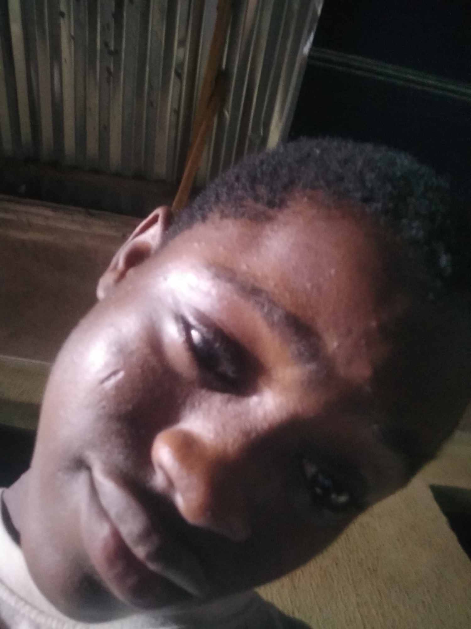 The image is a close-up selfie of a person with dark skin and short, dark hair. The person has a scar near their left eye. The background consists of corrugated metal sheets and a wooden surface. The location is not identifiable as Shangisha, Nigeria based on the visual content alone.