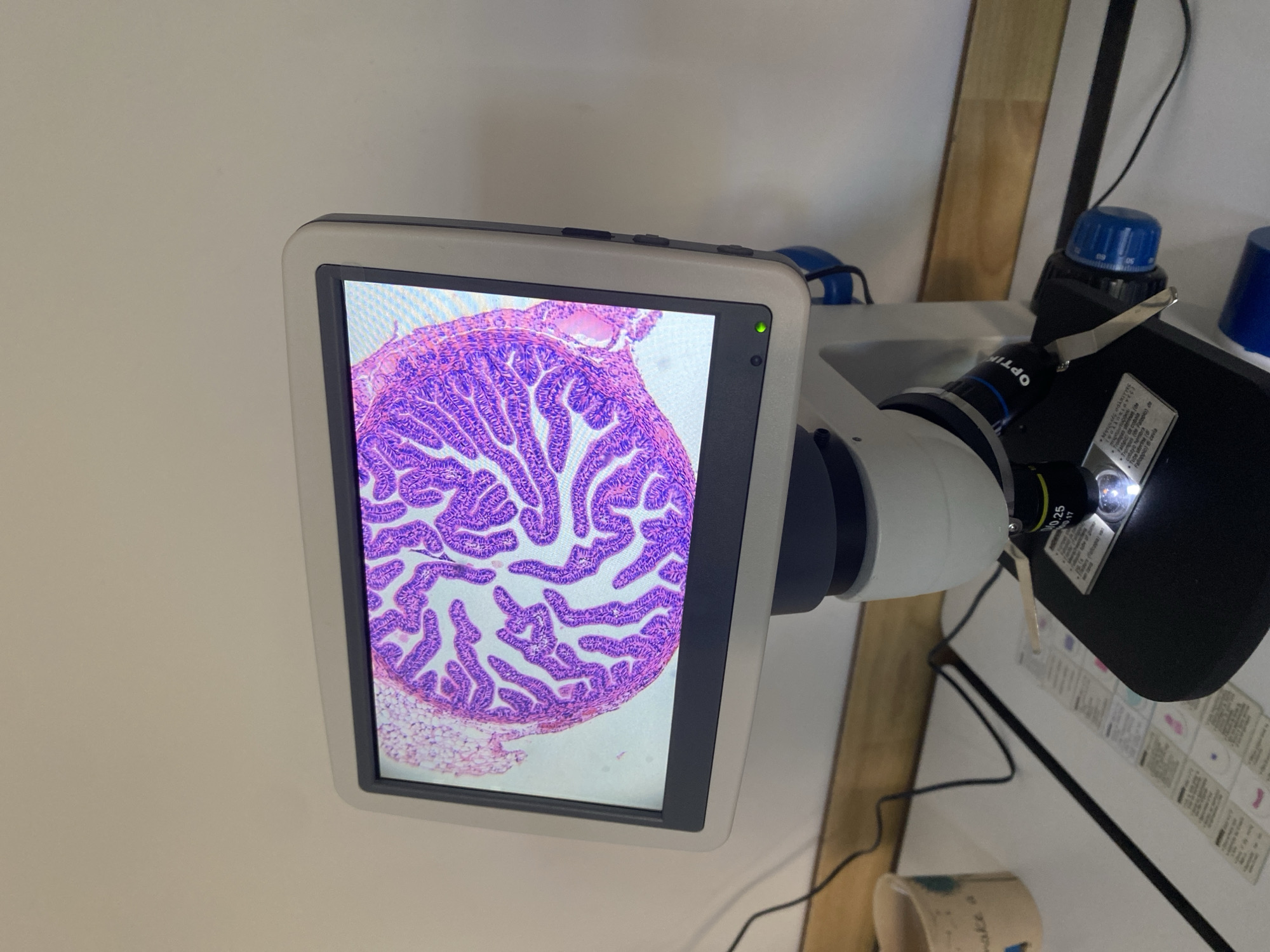 The image depicts a microscope with an attached digital screen showing a microscopic slide of tissue. The tissue appears to be folded or branched, stained purple. The microscope has a black light source and multiple adjustment knobs. A white table is partially visible, covered in labels with text in a foreign language. A coffee cup is also on the table. The location in Burgas, Bulgaria is not specified in the image.