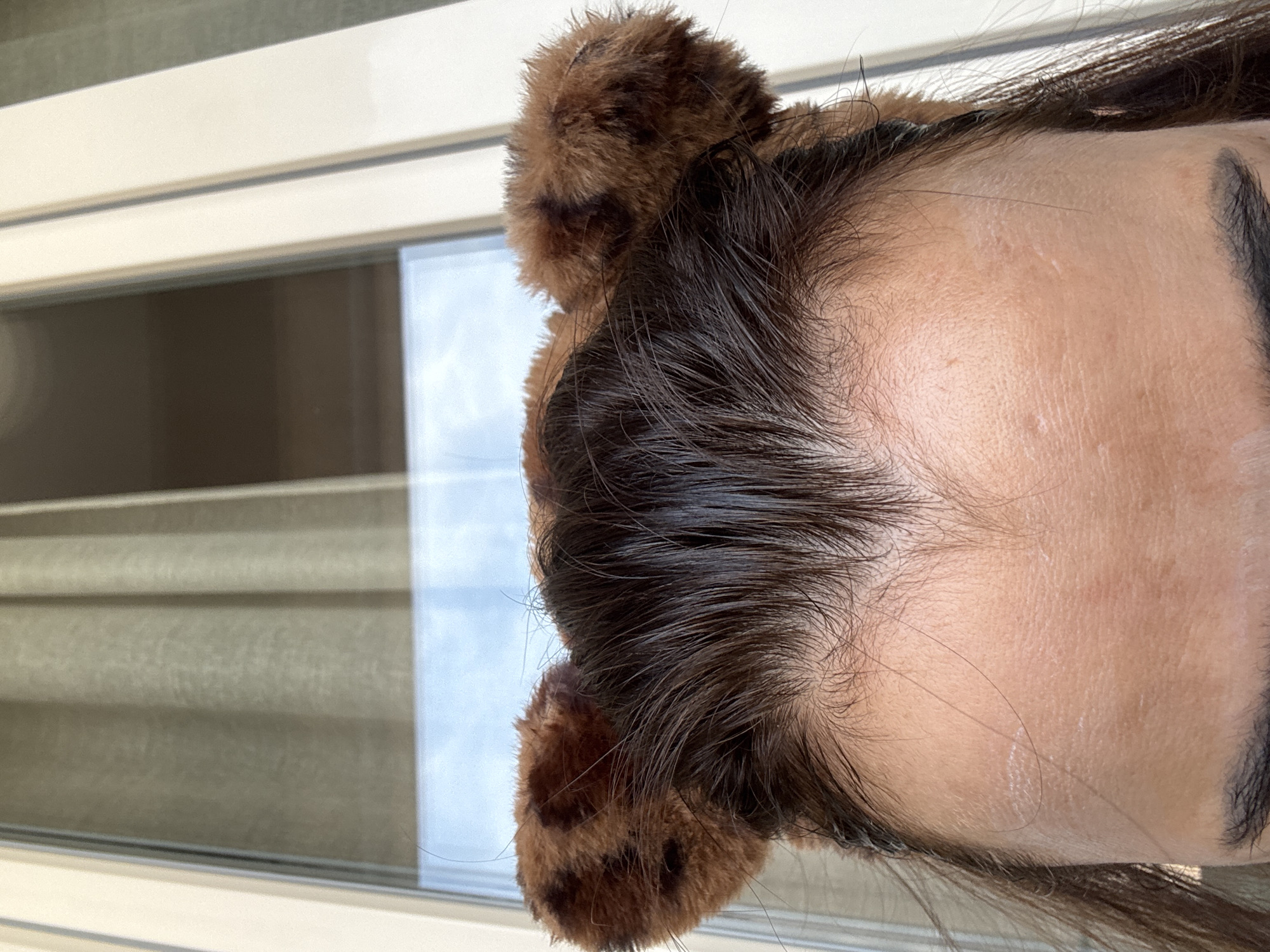 The image shows a close-up of a person's forehead and the top of their head, adorned with faux animal ears, likely part of a costume. The ears are brown with black spots and appear to be made of fuzzy material. The person has dark brown hair, which is slightly damp and styled down around their face. Their forehead is visible, showing skin texture and some light marks. Behind the person, a blurred background consists of vertical blinds or curtains and glass, suggesting an indoor setting near a window or door. The overall lighting is bright, possibly from natural daylight. There are no visible clues to pinpoint the location in a city.