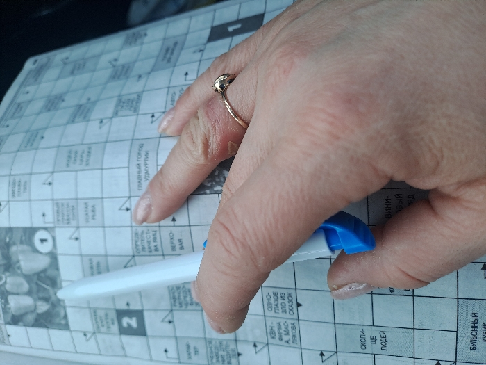 A close-up, high-angle shot captures a person's hands interacting with a Russian-language crossword puzzle in Novaya Derevnya, Russia. The right hand is prominently featured, with its index finger positioned above a clue. A gold-colored ring with a small, spherical top is present on the ring finger of the right hand, with noticeable skin irritation and dryness visible on the finger around the ring. A white pen with a blue cap is held by the partially visible left hand, pointing towards the puzzle. The crossword sheet displays various grid squares and Russian text, including a visual clue of bell peppers labeled '1' and a large number '2' for another section. The hands exhibit natural skin texture and unmanicured fingernails. The background is indistinct and out of focus.