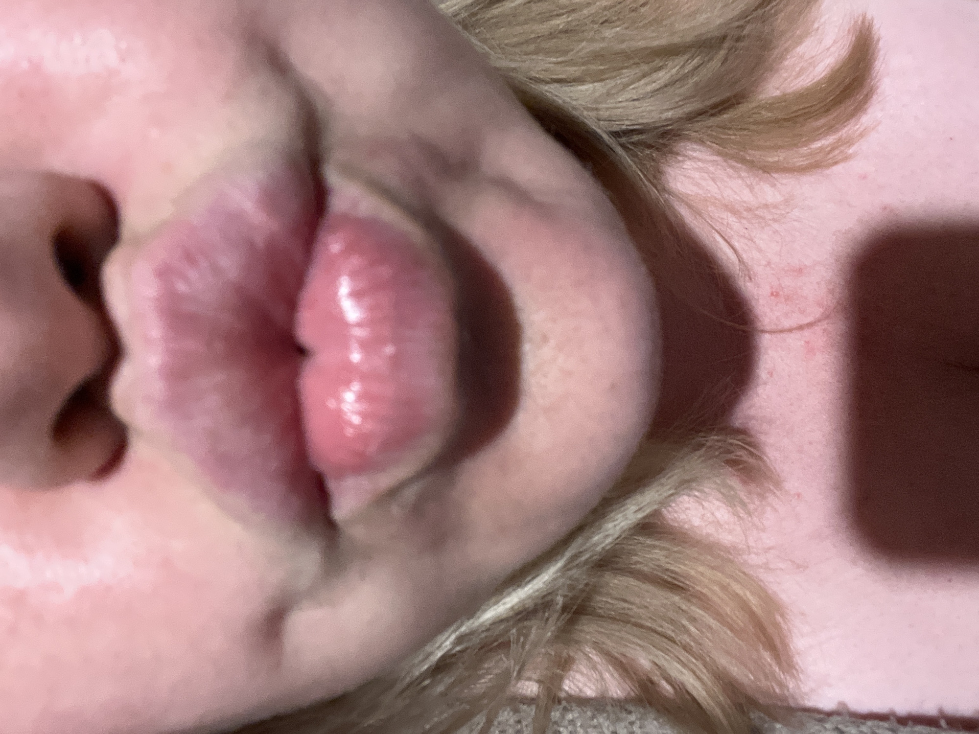 The image shows a close-up of a person's face, including the lips, nose, part of the cheek, and some blonde hair. The lips are prominent and appear somewhat swollen or plump. The skin is fair. The context of the location in Vesyoloye, Russia is not clear from the image.