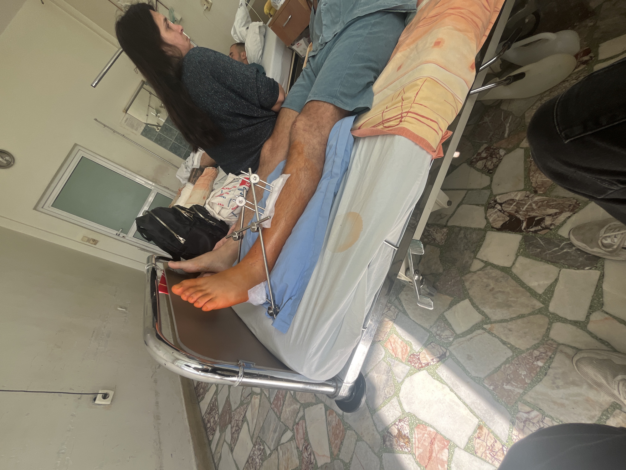 The image captures an interior scene, likely a hospital room, featuring two main individuals and the partial presence of a third. On the left, a woman with long, dark hair, wearing a dark blue-grey sweater, sits upright on a hospital bed, looking upwards and to the right, possibly observing something outside the frame or in thought. Adjacent to her, a man lies on another hospital bed, dressed in a light blue shirt and shorts. His right leg is notably elevated and supported by a blue medical drape or pillow. An external fixator, a metallic orthopedic device, is clearly visible on his lower right leg. His right foot and lower ankle are distinctly orange, consistent with the application of an antiseptic solution such as iodine. A dark, somewhat circular stain is present on the white sheet covering his lower body.
The room features plain light-colored walls and a distinctively patterned tiled floor, composed of irregular, mosaic-like shapes in shades of beige, brown, and green, interspersed with white grout. Sunlight streams into the room, creating bright patches on the floor. A black shoulder bag rests on the floor beside the woman's bed. A white plastic bag with Cyrillic text, including the prominent word "ТРАНСПОРТ" (TRANSPORT), is visible near the woman on her bed. Underneath the man's bed, a pair of white slippers is visible. A simple electrical outlet is situated low on the wall. In the immediate foreground, the feet of a third person, wearing sneakers and dark trousers, are visible, suggesting they are standing near the beds, possibly taking the photograph. The scene suggests a recovery or visiting context within a medical facility during daylight hours.