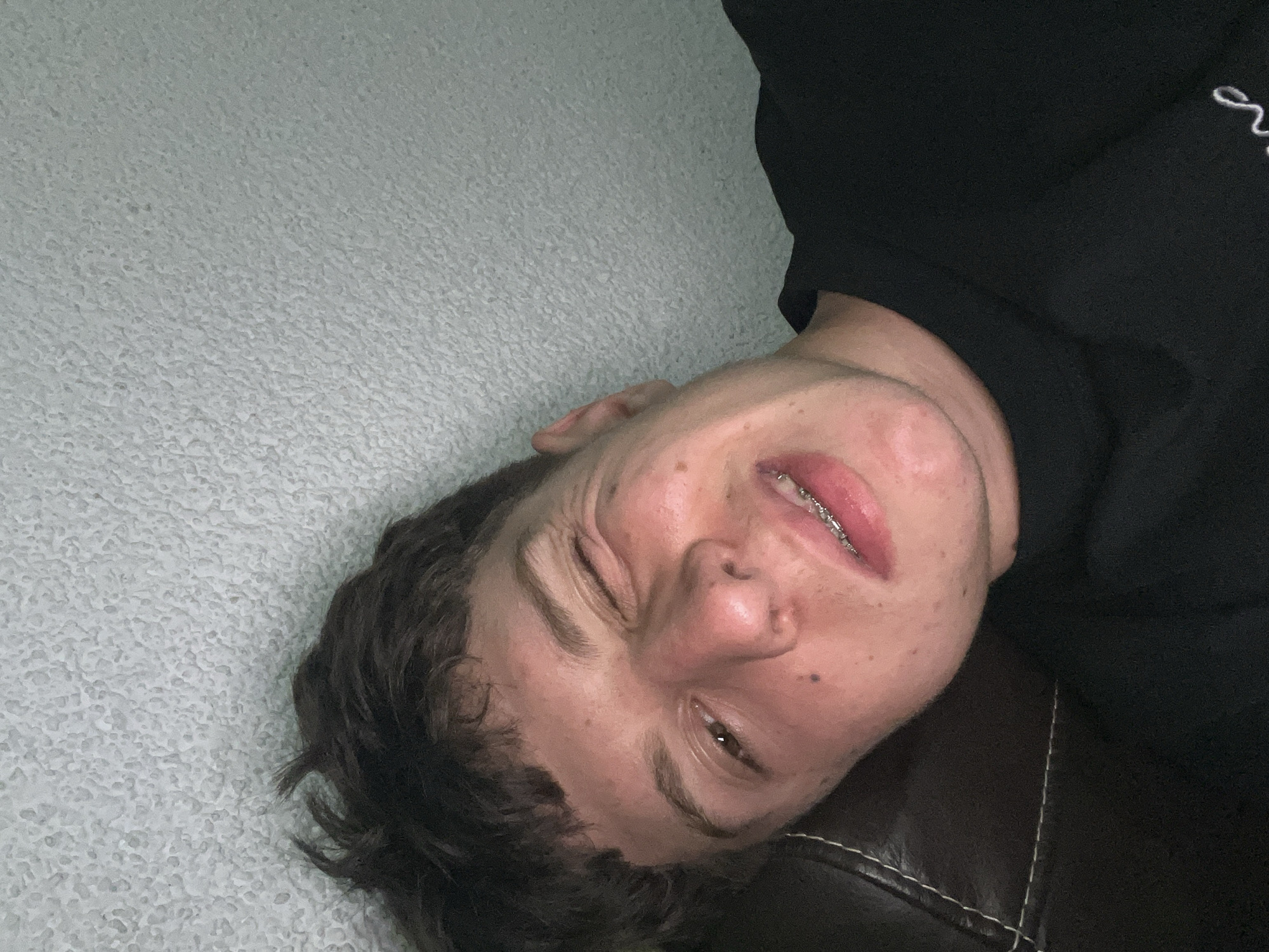 The image displays a close-up, informal portrait of a young male with a playful or exaggerated expression, winking his right eye (viewer's left) while his left eye remains open. His mouth is slightly open, revealing metal braces on his upper teeth. Noticeable wrinkles are visible around his winking eye. He has dark, messy hair with a fringe over his forehead, and several small moles or blemishes are present on his face. He is wearing a plain black, long-sleeved garment, likely a shirt or sweatshirt. The background consists of a light grey, heavily textured wall on the right and upper portion of the frame. To the lower left, a dark brown, possibly leather or faux leather, surface with prominent white stitching is visible, suggesting a couch or upholstered chair. The scene appears to be indoors with soft, ambient lighting. There are no discernible elements in the image that indicate the location is Zlatograd, Bulgaria.