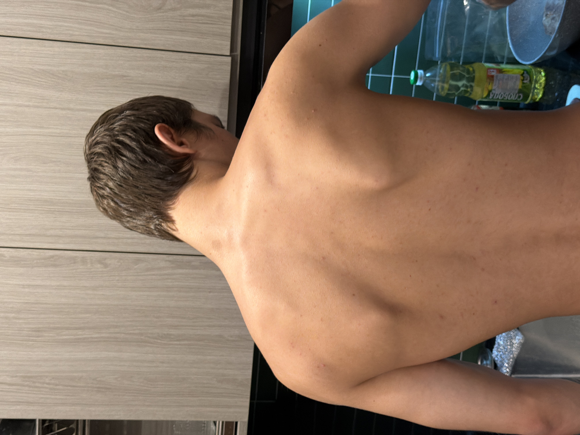 The image shows the back of a shirtless young man standing in a kitchen. He has light brown hair and is facing away from the camera. His back has some scattered red marks, possibly acne. In the background, there are kitchen cabinets, a sink with some objects, a bottle of cooking oil, and a bowl. The kitchen appears to be modern with light-colored wooden cabinets and dark green tiled backsplash. The lighting is moderate, and the image has a slightly grainy quality. There is no discernible information in the image that could place it in the city of Da Nang, Vietnam.