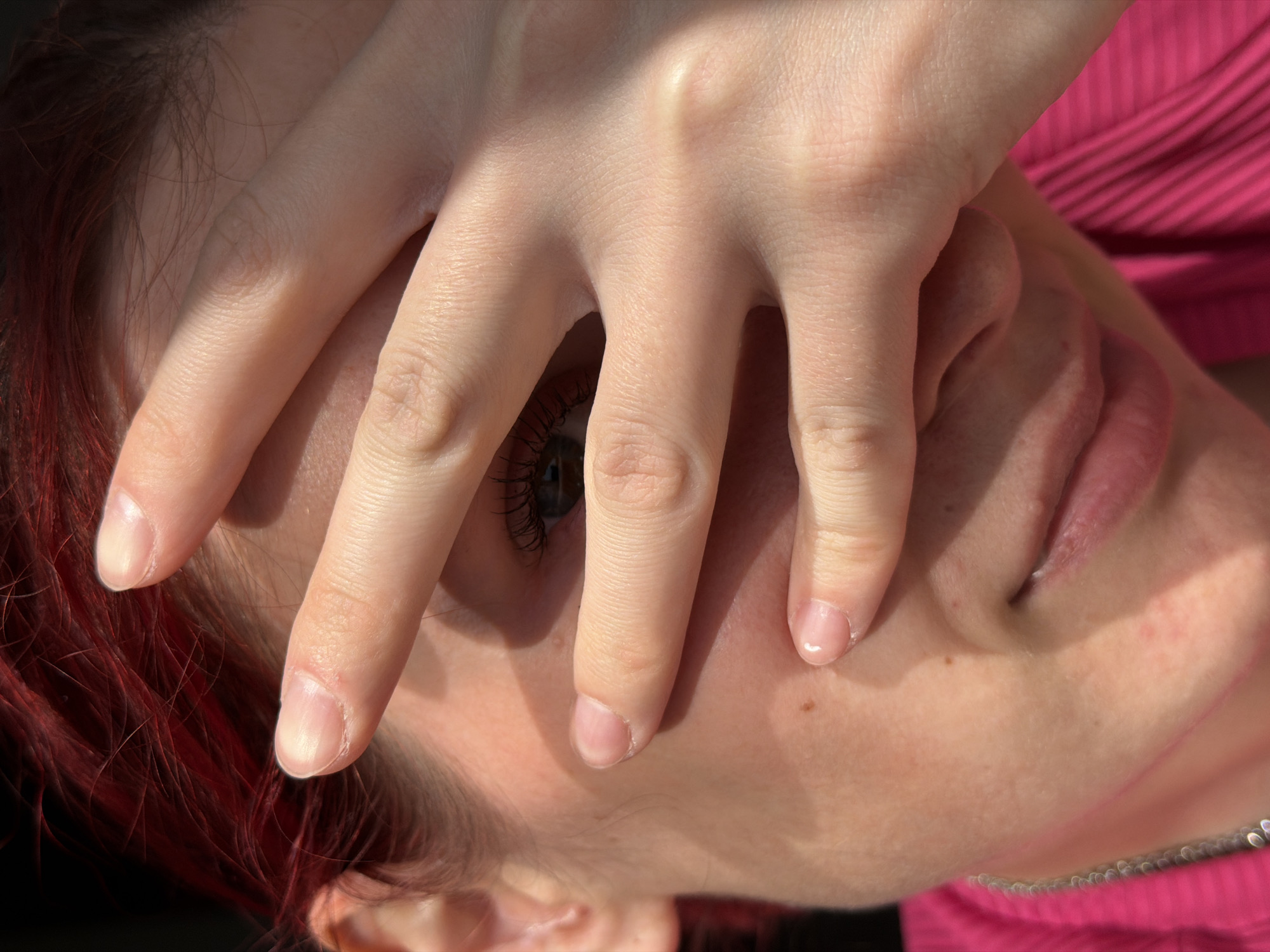 A close-up, slightly angled, portrait of a person's face, partially obscured by their hand. The person has fair skin, visible at the cheek, nose, and forehead. The hand covers most of the face, with fingers spread. One green-blue eye is visible through the gaps between the fingers, with visible eyelashes. The person's lips are slightly parted. Red hair is visible at the top left of the frame. A pink striped garment is visible in the top right of the frame. A silver necklace is visible at the bottom right. The lighting is bright, casting shadows on the face and hand. The setting and location in Chaikovsky, Russia, are not apparent in the image.
