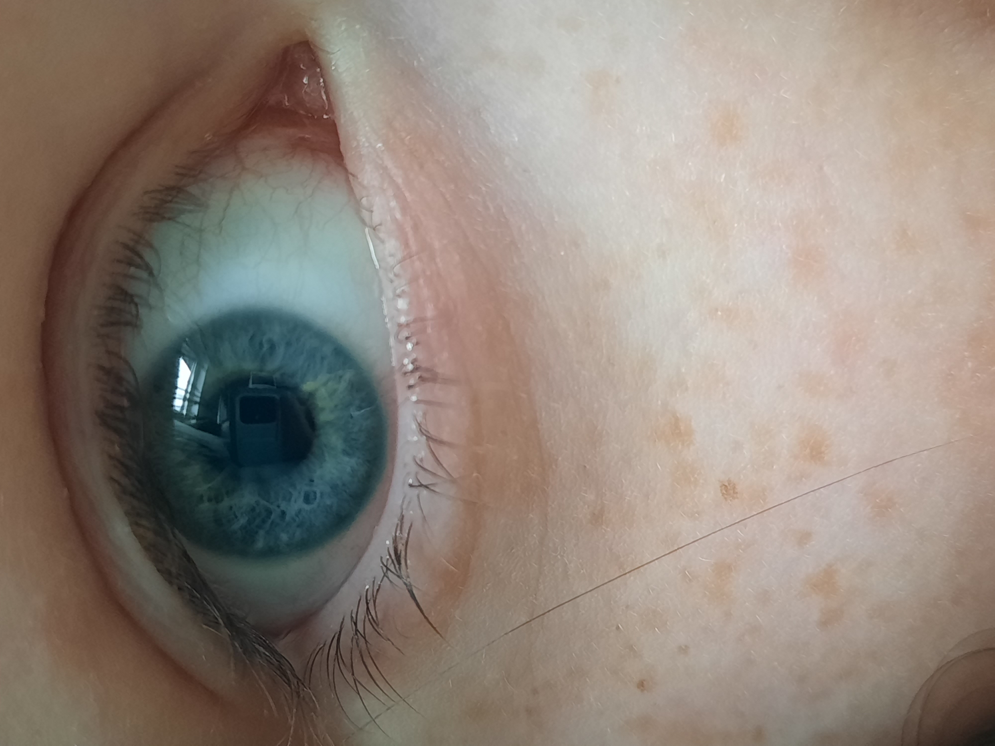 A close-up photograph shows a human eye with a blue iris, capturing the details of the sclera, eyelashes, and surrounding skin. The skin exhibits freckles. The reflection in the eye reveals an interior scene with furniture and lighting fixtures. The location Krasnogorskoye, Russia, is unrelated to the image as there is no geographical information.