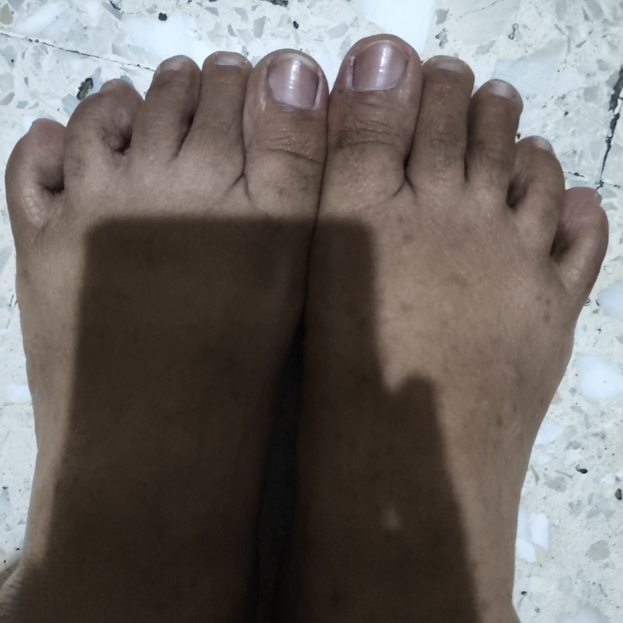 The image shows a close-up, overhead view of two feet resting on a speckled, light-colored tiled floor. The feet are positioned side-by-side, with the toes pointing upwards. The skin on the feet appears tanned, with some visible wrinkles and small, dark spots. The toenails are short and appear to be clean. There are shadows cast on the feet and the floor, suggesting an overhead light source. The background tiling is a common pattern found in residential or public spaces, likely a bathroom or kitchen floor in a house or apartment building in South Jakarta, Indonesia.