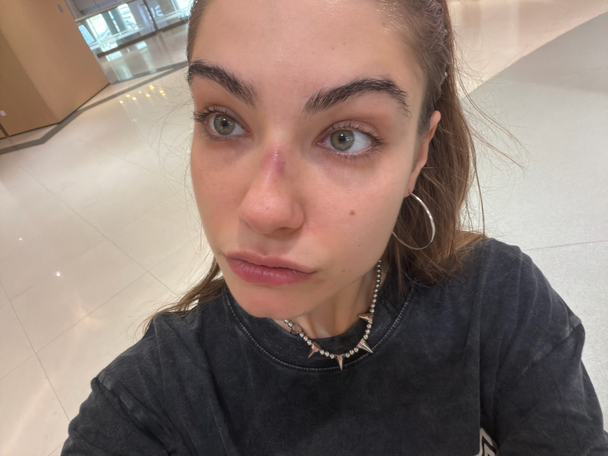 A young woman with light brown hair and green eyes is taking a selfie in what appears to be a public indoor space, possibly an airport or shopping mall, given the polished tile floor and large windows in the background. She is wearing a dark grey t-shirt and a spiked necklace. A bruise is visible on the bridge of her nose. The lighting is bright and diffused.