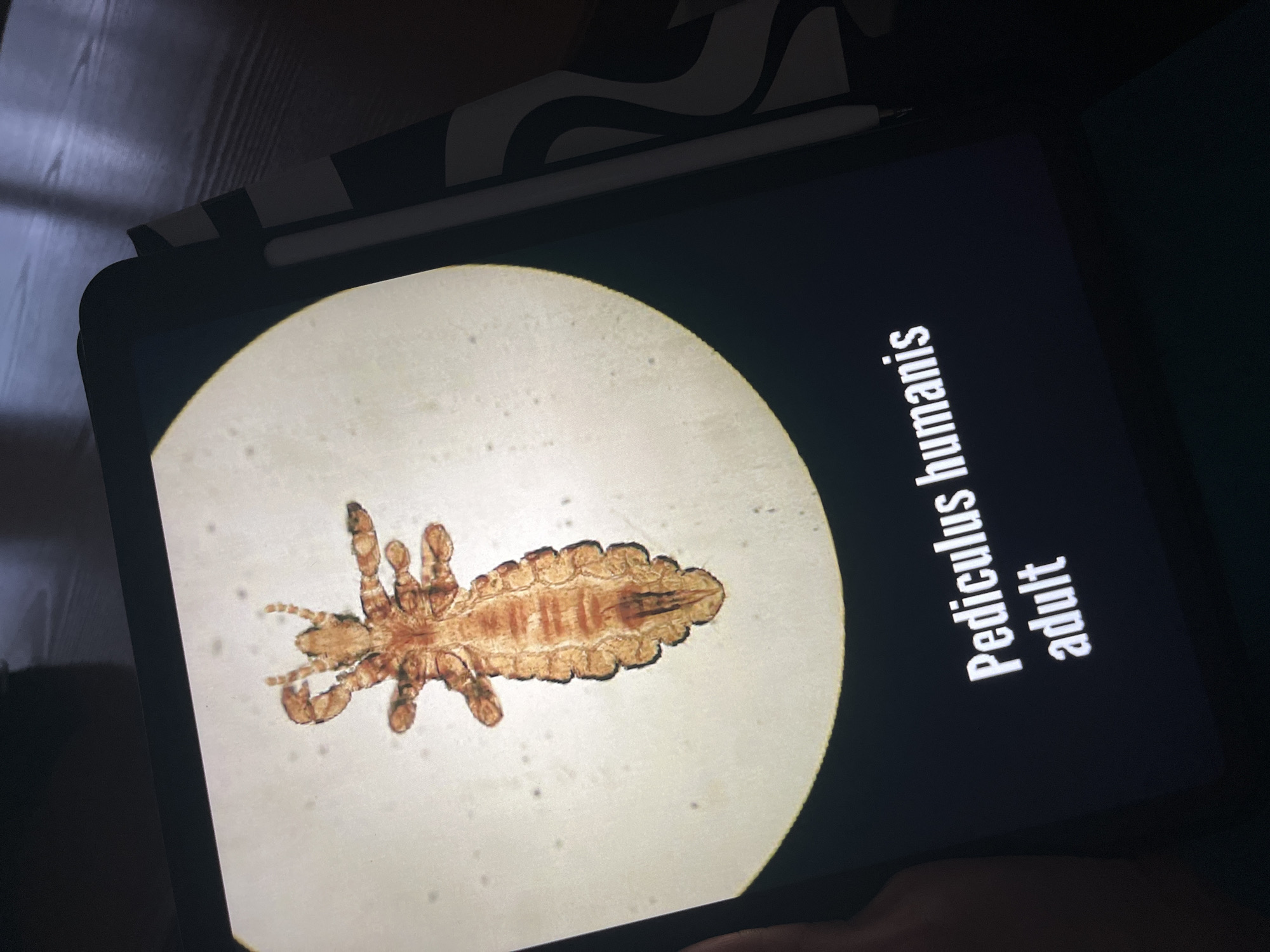 The image shows a tablet displaying a microscopic image of a "Pediculus humanis adult," commonly known as a human body louse. The background behind the tablet is dark. The tablet is in a black case, and a white stylus pen is on top of the tablet. The location is unknown.