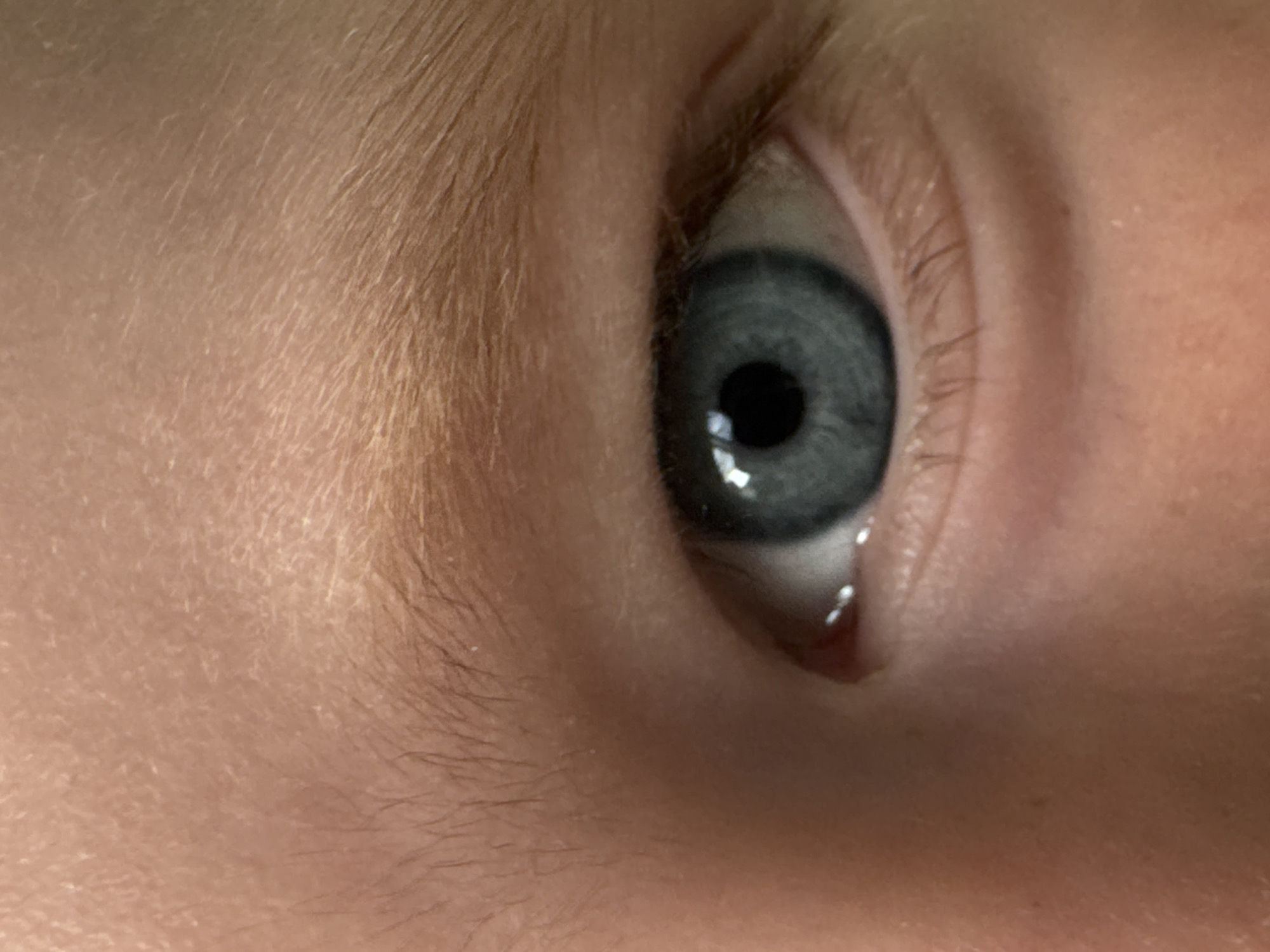 The image shows a close-up of a human eye. The iris is bluish-gray with a dark pupil. Eyelashes are visible. The skin surrounding the eye is light-colored and has fine hair. No location in Chaikovsky, Russia is evident in the image.