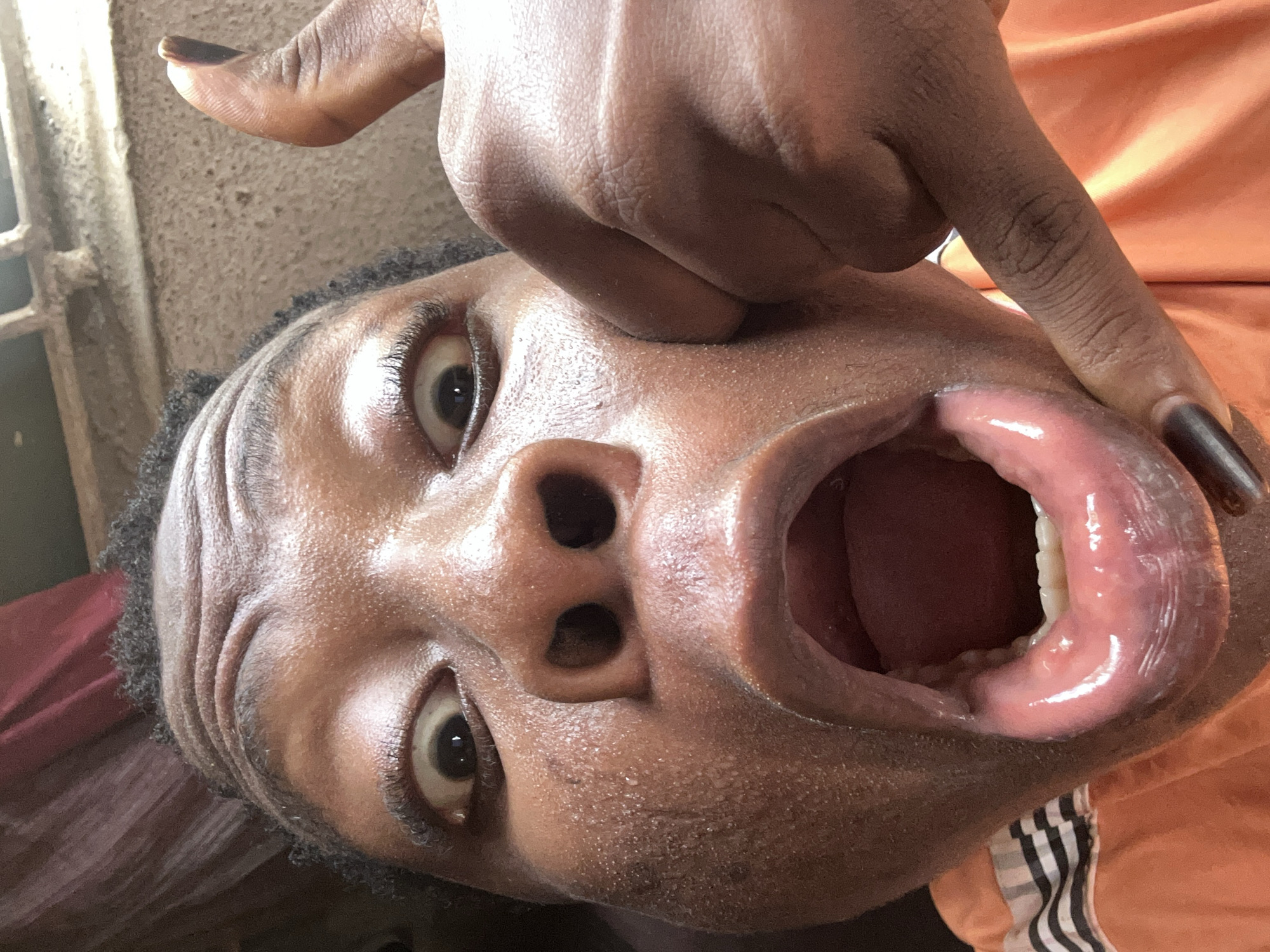 A close-up, disorienting portrait shows a person with dark skin from an unusual, possibly tilted or overhead angle. The subject's face is central, with both eyes wide open and looking directly at the viewer. Their mouth is agape, and a hand with dark nail polish on one finger is pulling down the lower lip, revealing the moist, pink interior of the mouth, including the gums, white teeth, and tongue.
The person's skin is somewhat shiny or oily, showing visible pores and subtle texture, particularly around the nose and cheeks. Dark, curly hair is visible around the edges of the face. The background is blurred but reveals a textured, light-colored wall or surface and what appears to be a metallic window grate on the left. Bits of clothing are also visible: an orange fabric with black and white stripes (suggesting sportswear) on the right side, and a dark red or maroon fabric on the left. The scene is brightly lit, likely by natural light, creating highlights on the skin and inside the mouth. No text is visible. The exaggerated expression, with the wide-open eyes and mouth, suggests surprise, playfulness, or a deliberate act of showing the inside of the mouth.