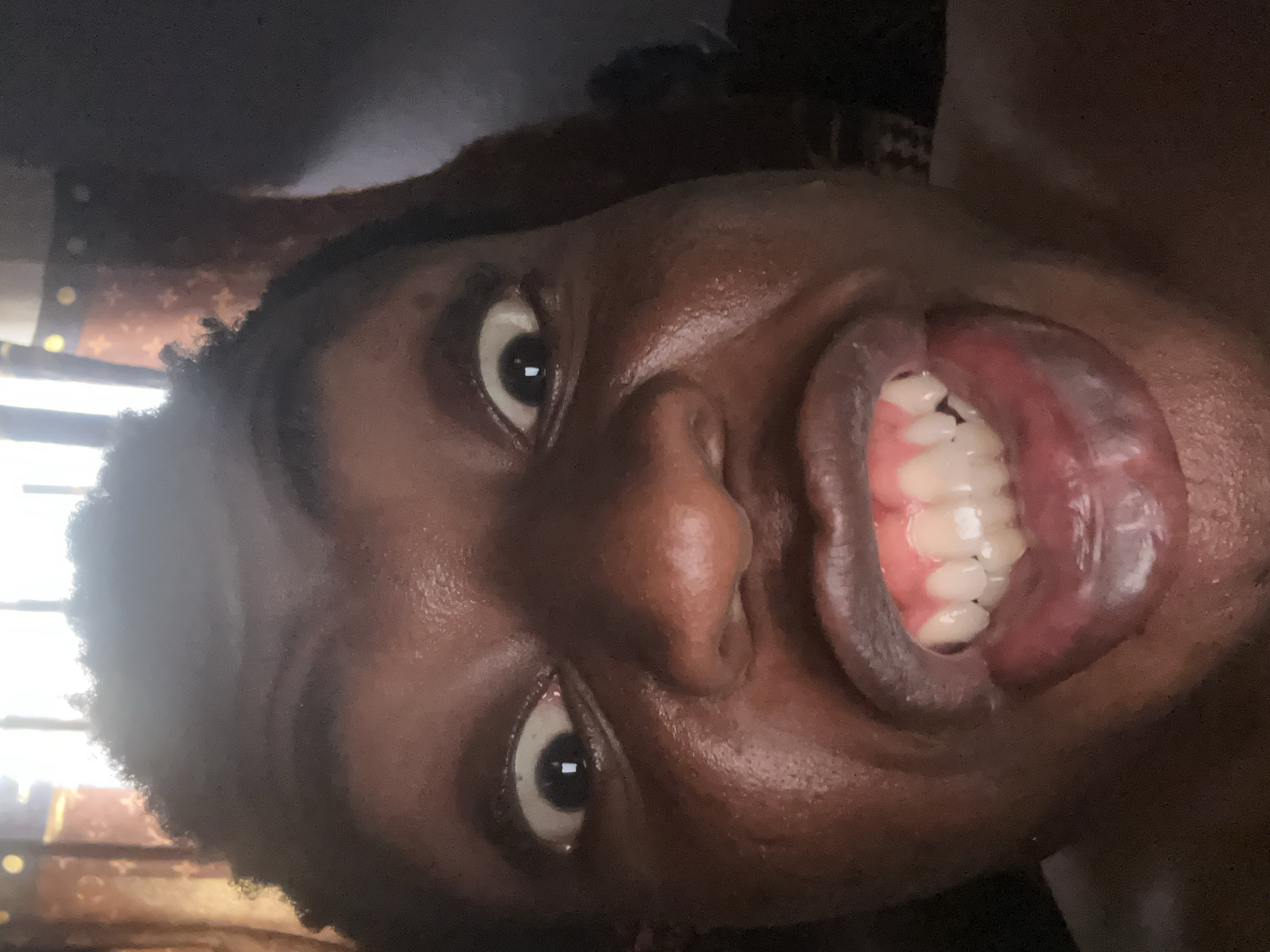 A close-up, rotated perspective depicts a person's face. The person has dark skin, curly black hair, and wide eyes. The mouth is open, revealing white teeth and pink gums. The background is blurred, suggesting an indoor setting with some light sources. No specific location in Unknown, Unknown is discernible from the image.
