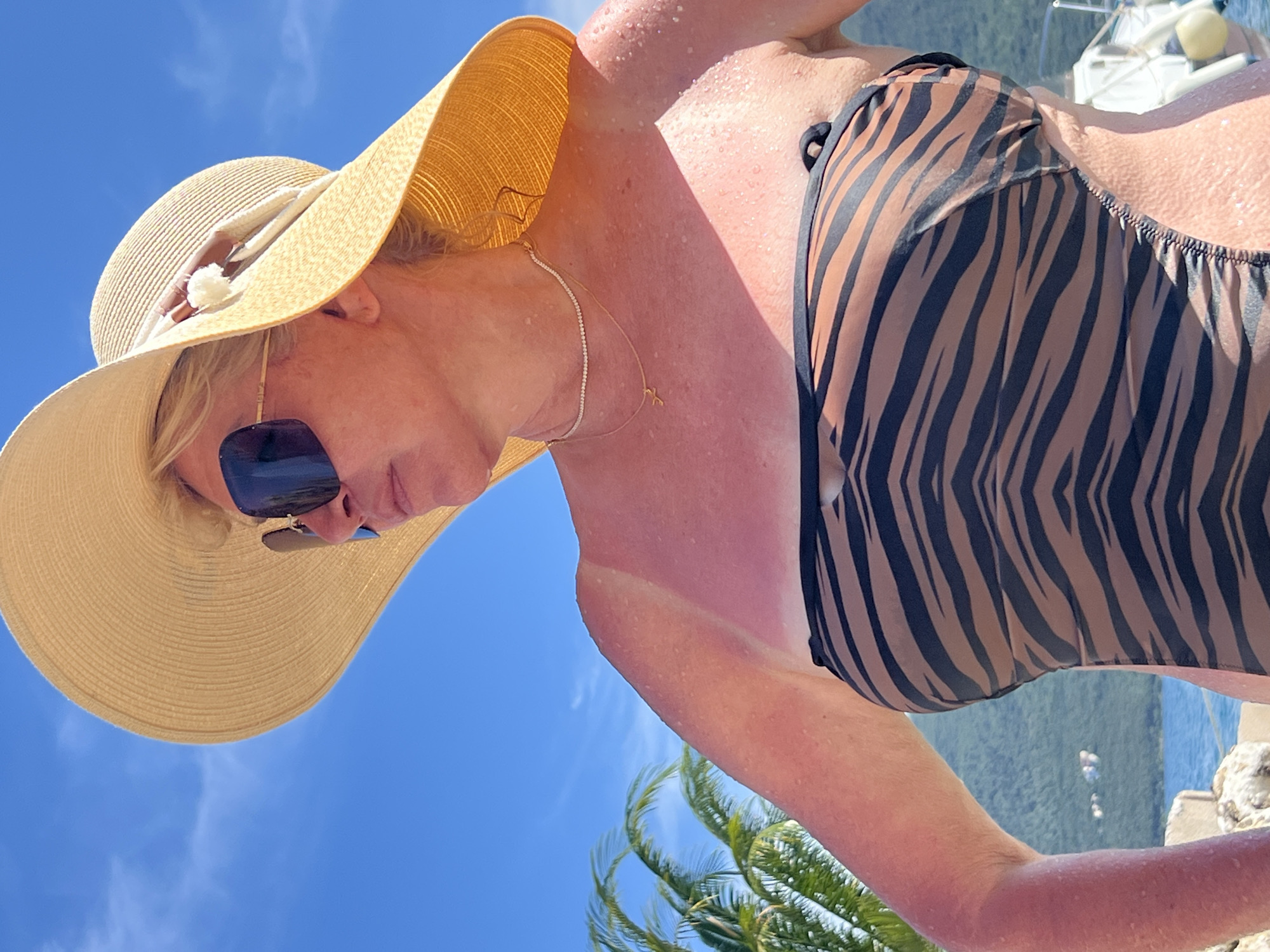 A woman is pictured outdoors, likely in Baošići, Montenegro, on a sunny day. She is wearing a wide-brimmed straw hat, sunglasses, and a brown and black striped swimsuit. Her skin, particularly on her arms and chest, appears reddened and is dotted with water droplets, suggesting she has recently been in the water or is sweating. A clear tan line is visible on her upper arm. She is looking to her right, away from the camera. In the background, a palm tree is visible to the left, and a body of water with a distant mountainous landscape can be seen. A portion of a boat is also present on the right side of the image. The sky is a clear, bright blue.