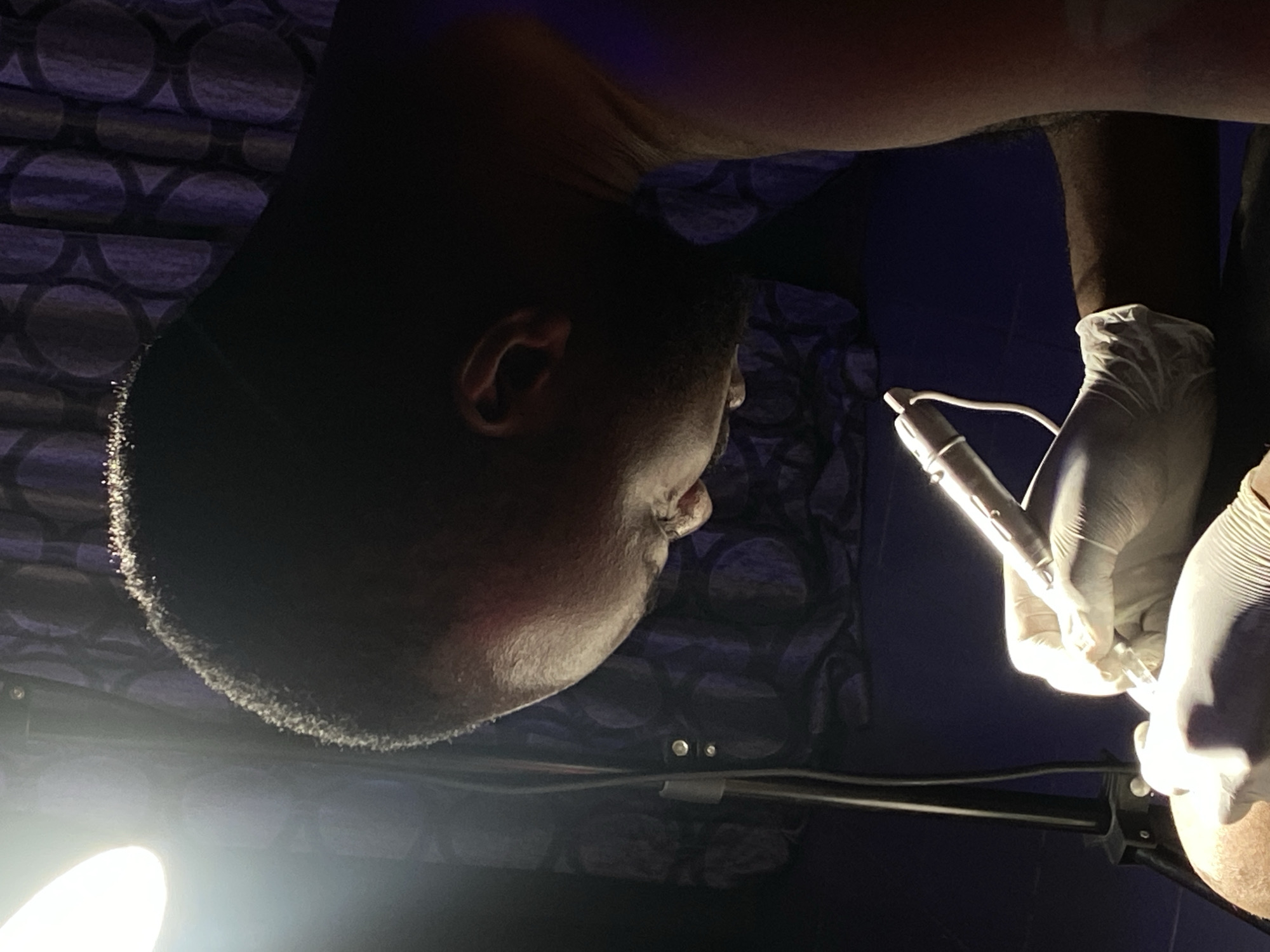 In Bar Jirgi Summa, Nigeria, a person is getting a tattoo on their head. The tattoo artist, wearing white gloves, is using a tattoo machine to create the design. The scene is illuminated by a bright light, casting shadows on the background which features a patterned curtain. The tattoo artist's face is partially obscured by the lighting and angle, but their focus is clearly on the task at hand. The overall atmosphere suggests a private session, possibly in a home or a small studio.