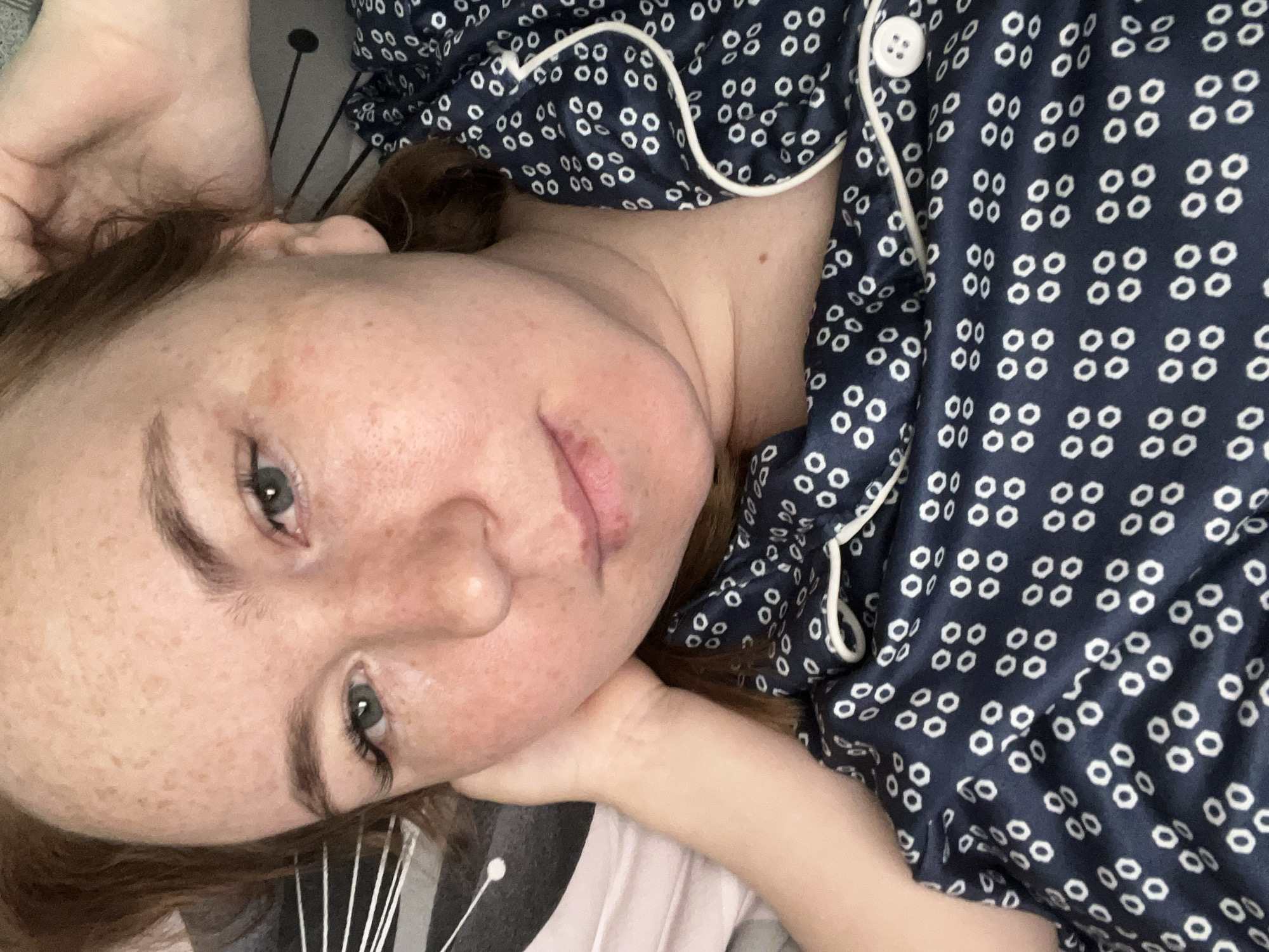 The image shows a person, presumably a woman, lying down, likely in a bed. She is wearing what appears to be a blue and white patterned pajama top with a button. Her head is resting on her hand. She has fair skin, freckles, light brown hair, and light-colored eyes. The background consists of bedding. The location in the city of Chaikovsky, Russia is unknown.