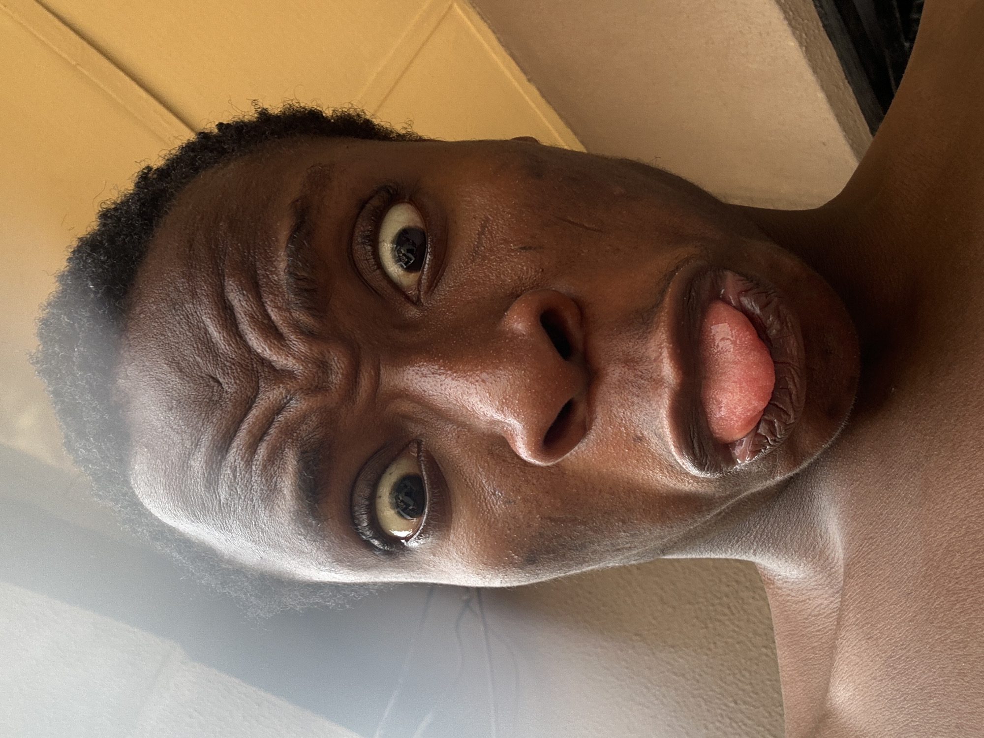 The image shows a close-up of a person's face. The person has dark skin, and their facial expression is exaggerated with furrowed brows, wide eyes, and their tongue sticking out. Their hair is short and dark. The background consists of light-colored walls. The location is unknown.
