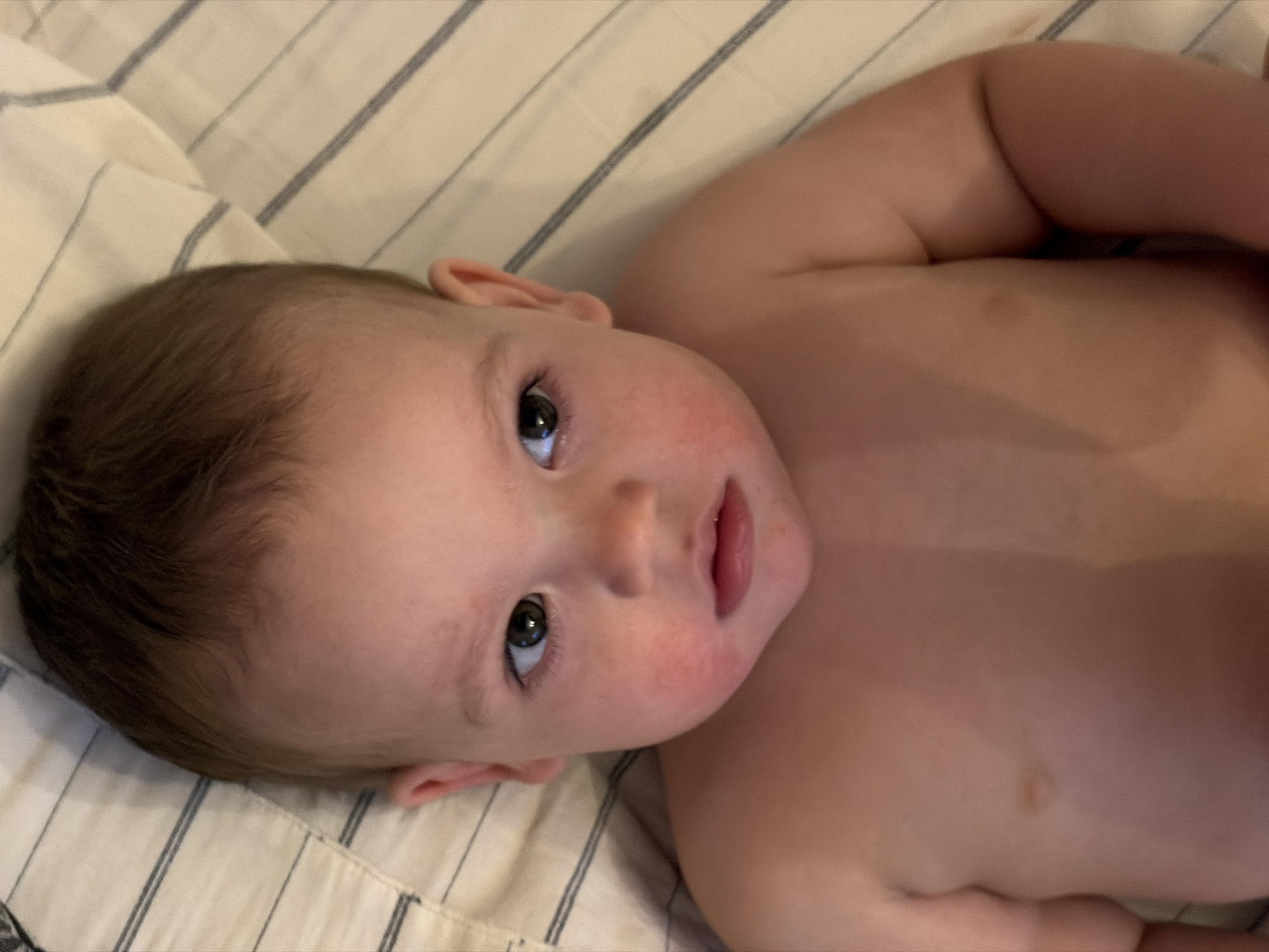 A close-up, overhead shot shows a fair-skinned baby lying on a striped bedspread. The baby is facing the camera with its head slightly tilted to the right. The baby has light brown hair, hazel eyes, and pink cheeks. Its mouth is slightly open, revealing a small portion of its teeth. The baby's shoulders and chest are visible, with a small, brownish birthmark on its chest. The background is a cream-colored bedspread with thin, dark blue stripes. The lighting is warm and appears to be from an artificial source. The image quality is slightly grainy. This image was not taken in Chaikovsky, Russia.