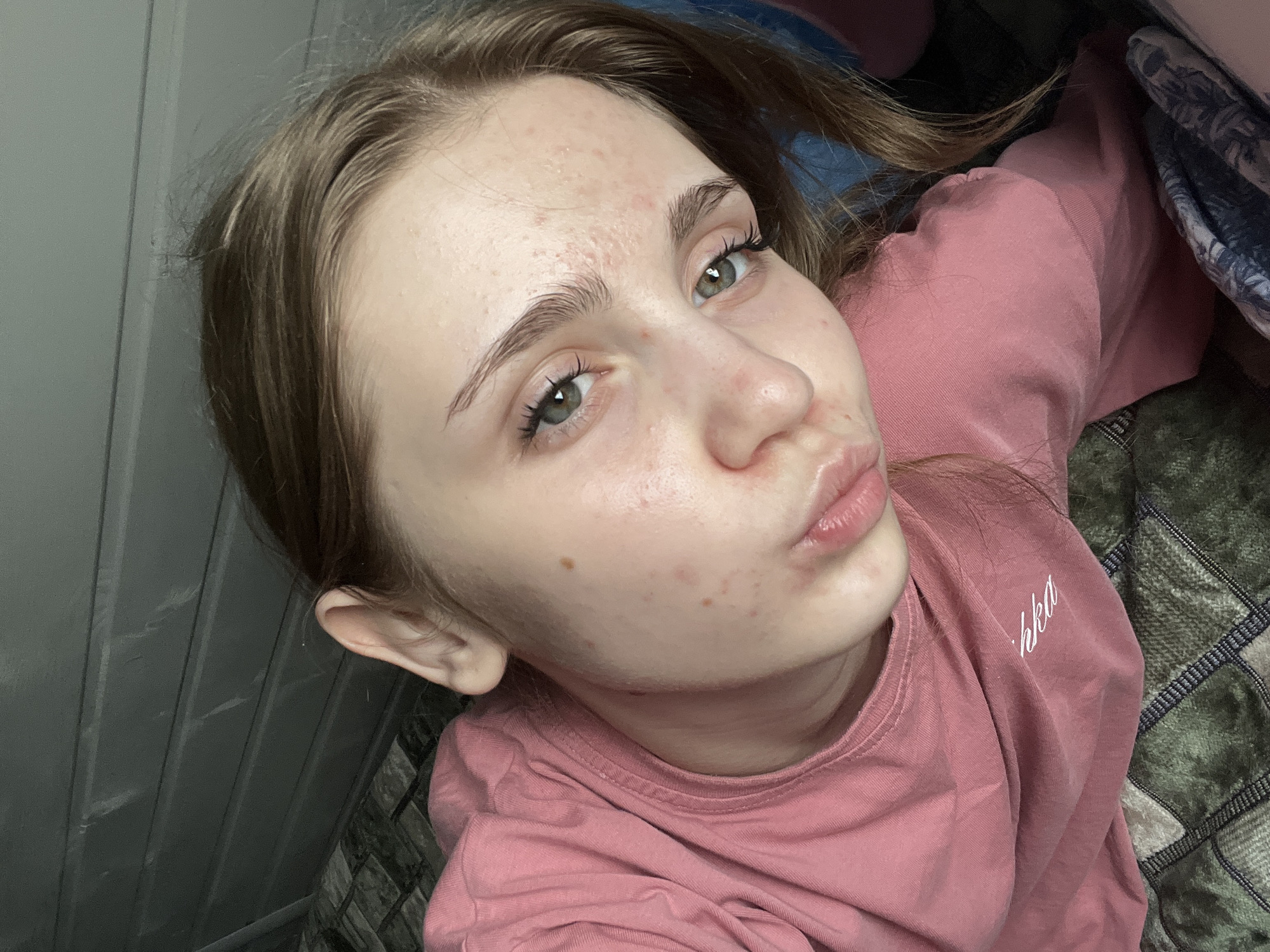 The media file is a close-up selfie of a young person with light brown hair, light skin, and green eyes. The person is wearing a pink t-shirt with white lettering on the left shoulder that appears to say "Bkka". They are making a puckered-lip expression, often referred to as "duck face," and their gaze is directed towards the camera. The background is slightly blurred, but it appears to be an indoor setting with textured walls and bedding visible. The lighting suggests it is daytime. The person's face has some visible blemishes, which might indicate a mild skin condition. The overall mood seems casual and playful. The provided location context is Ashkadar, Russia.