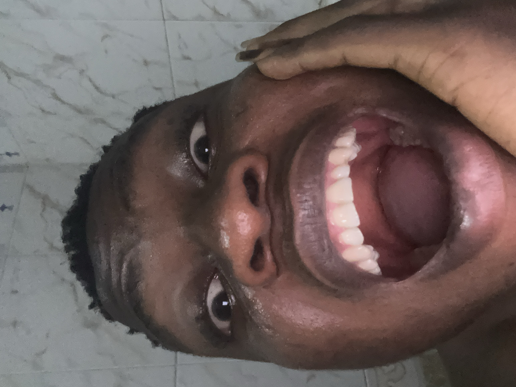 The image displays a very close-up, frontal portrait of an individual with dark skin and short, dark, textured hair. The person's face occupies most of the frame, captured in an expressive moment. Their eyes are wide open with visible whites surrounding dark pupils, which reflect a pinpoint of light. The forehead exhibits several horizontal wrinkles, indicative of a raised brow. The mouth is open extremely wide, revealing both upper and lower teeth, which are white and regularly aligned, as well as the pink interior of the mouth and a visible tongue. The skin on the face appears to be somewhat moist or glistening. The individual's right hand is positioned against the right side of their face, near the cheek, with the fingers lightly pressed against the skin. The background consists of a tiled wall with a light, possibly off-white or very light gray color, featuring faint, darker, wavy patterns, suggesting a marble-like or textured stone finish. Visible grout lines confirm it is a tiled surface. There are no elements within the image to forensically establish the specific urban location as Ikorodu, Nigeria.