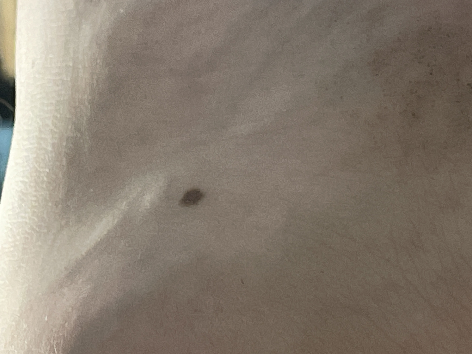 A close-up, overhead shot shows a single, dark brown mole on a person's skin. The skin appears to be a light tan color and shows texture from pores and fine lines. There are no other objects or people visible in the frame. The background is out of focus and shows a blurry mix of light and dark colors, possibly fabric or furniture. The image is taken from a very close perspective, focusing entirely on the mole and the surrounding skin. There is no information about the location in Sinyavino, Russia.