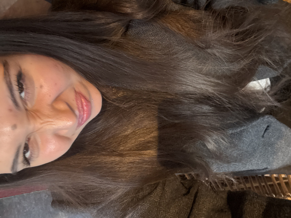 The image depicts a female subject from an overhead perspective, positioned centrally within the frame, in the city of Albi, France. Her head and upper torso are visible, with long, dark brown hair cascading over her shoulders and chest. The subject's face exhibits a distinct grimace, characterized by narrowed eyes, an upwardly wrinkled nose bridge, and downturned, compressed lips. Visible facial features include defined eyebrows and eyelashes. Several dark-pigmented macules are present on her forehead and right cheek. She is attired in a dark grey outer garment, consistent with a coat or jacket, displaying a textured, possibly herringbone, fabric weave. A lighter-toned garment is partially visible underneath the outer layer. In the lower left quadrant of the image, a section of a brown woven object, consistent with a wicker chair or similar furniture, is discernible. No other individuals or specific environmental markers of Albi are identifiable within the frame.
