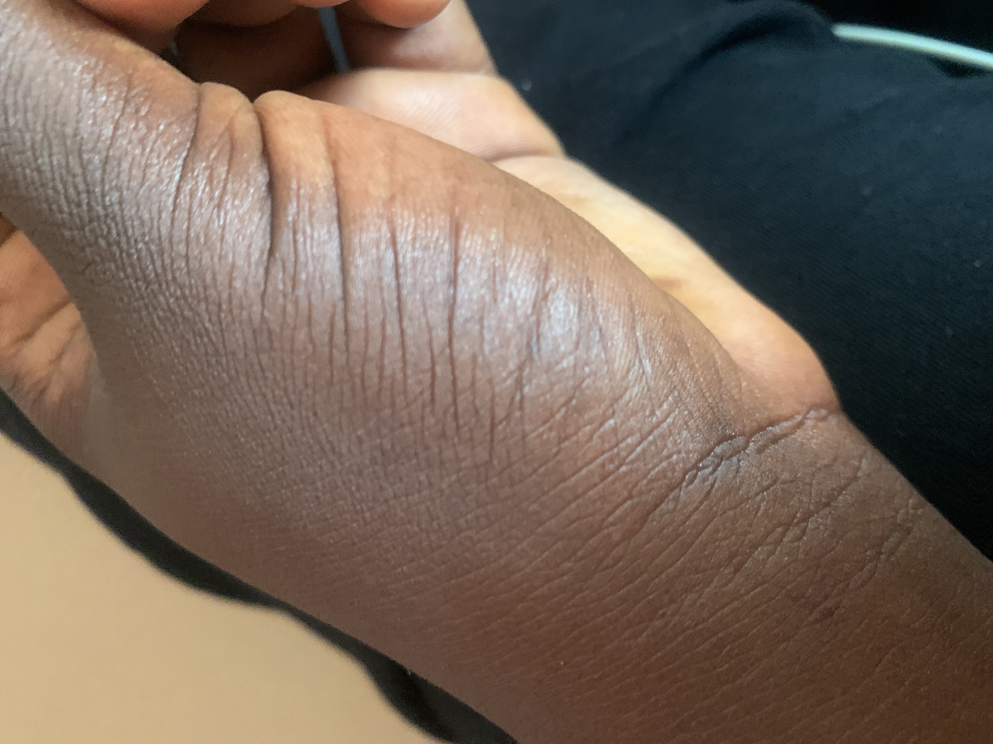 The image is a close-up of a person's hand, showing the texture of the skin, including wrinkles and creases. The skin is dark in tone. A portion of black fabric is visible in the lower right corner of the image. The background is a blurred, light tan color. The image does not depict any specific location within the city of Jauro Yinu, Nigeria.