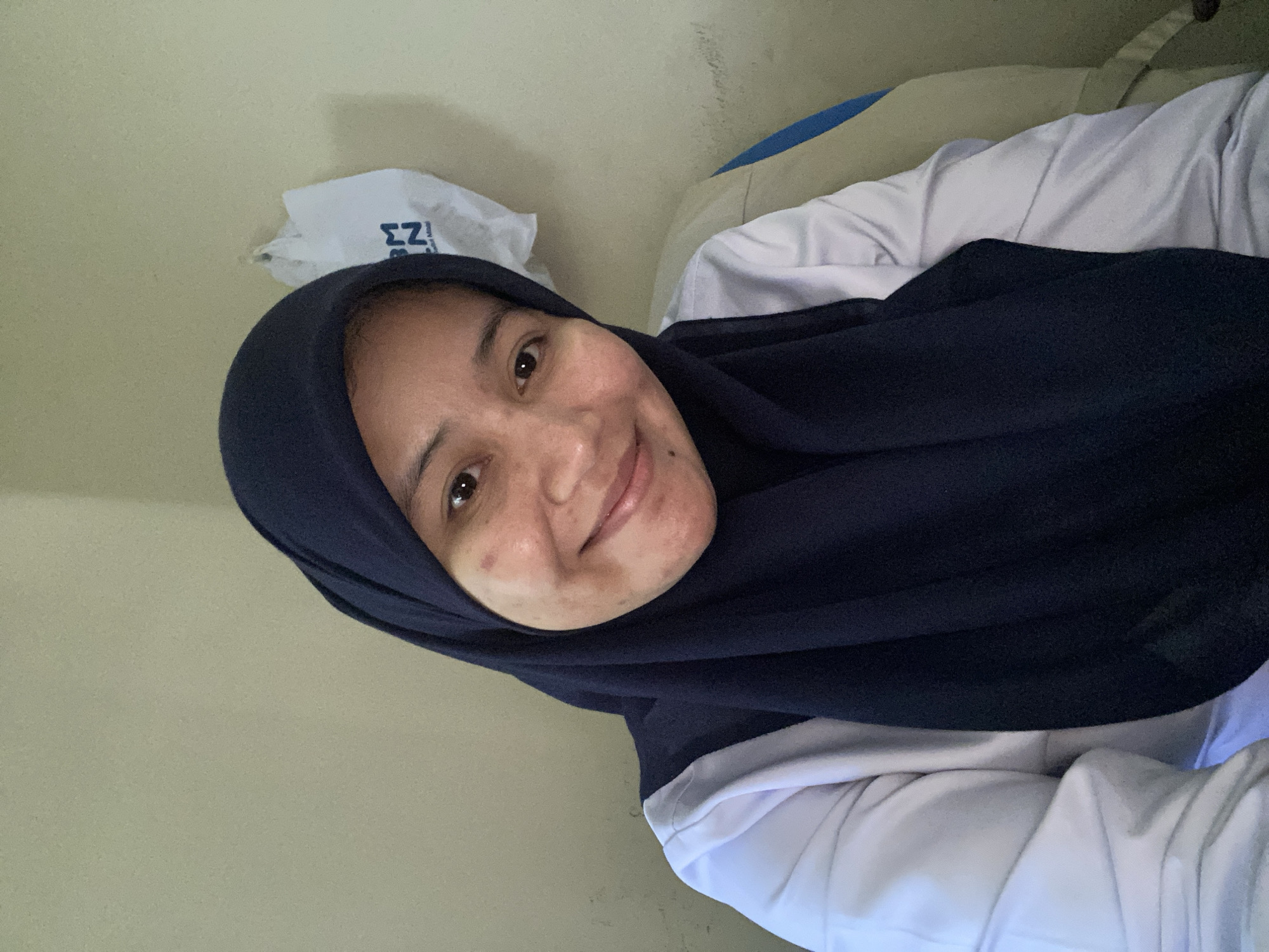 A woman wearing a dark blue hijab and a white top smiles at the camera. She has light brown skin and dark brown eyes. Her left cheek has a red mark and some acne. Behind her, a white plastic bag with black writing hangs on a wall. The background is a plain, light-colored wall. The image appears to have been taken indoors, possibly in a home or office setting, in Banjarbaru, Indonesia.