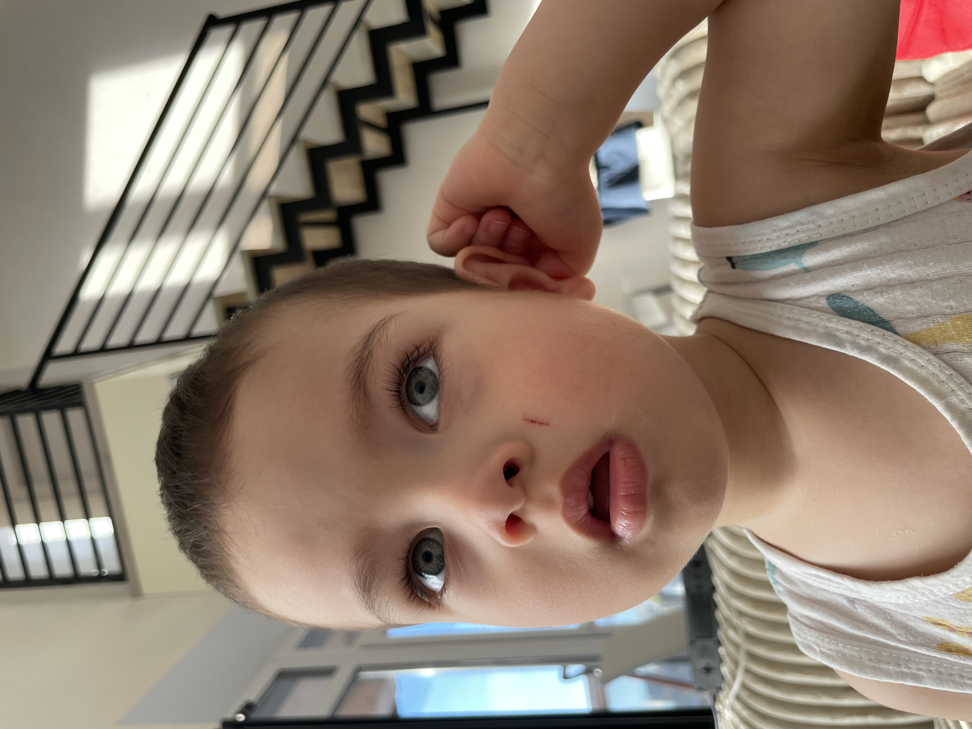 A close-up, low-angle, and rotated shot features a young child with fair skin, light brown hair, and gray-blue eyes. The child's right hand is raised near their ear. A small scratch is visible on the child's right cheek. The child is wearing a patterned tank top. In the background, there is a staircase with black metal railings and light-colored steps, along with a window showing a view of the sky. The location in Izhevsk, Russia cannot be determined from this image.