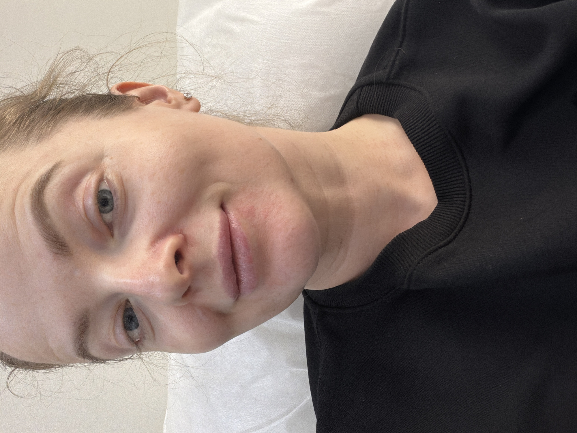 A woman with fair skin and blue eyes lies on a white surface. She is wearing a black sweatshirt with a ribbed collar. Her hair is light brown and slightly disheveled. She has a small earring in her left ear. The environment appears to be indoors, possibly a medical or beauty treatment room, indicated by the white surface she is lying on. There is no evidence to suggest this photo was taken in Moscow, Russia.