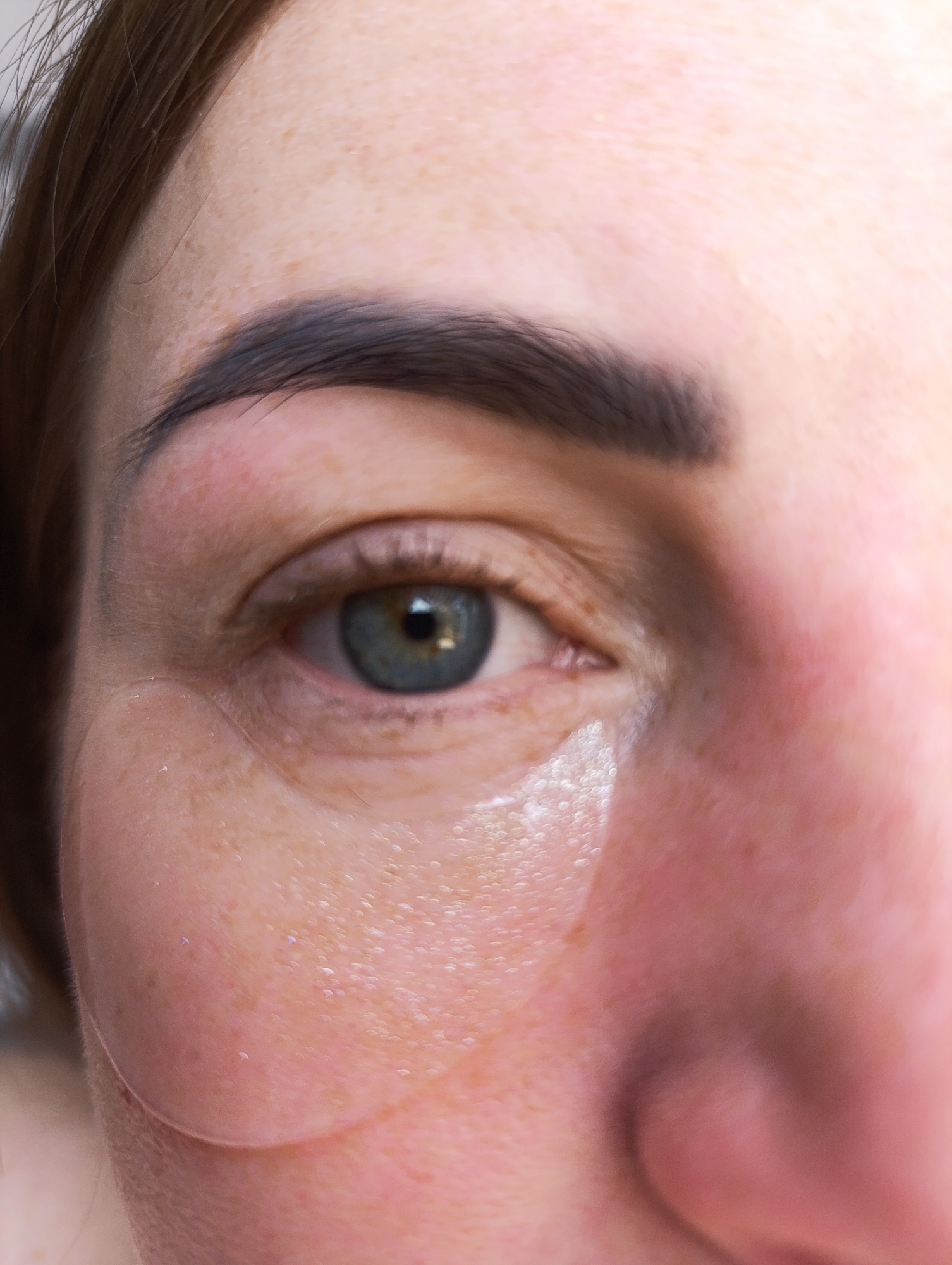 A close-up shot of the left side of a person's face. The eye is central with a grey-blue iris. A dark, thick eyebrow is above the eye. The skin is fair with freckles. The side of the nose is visible on the right side of the image. A shiny, wet substance is visible under the eye and extends down the cheek. Location: Unknown, Unknown.