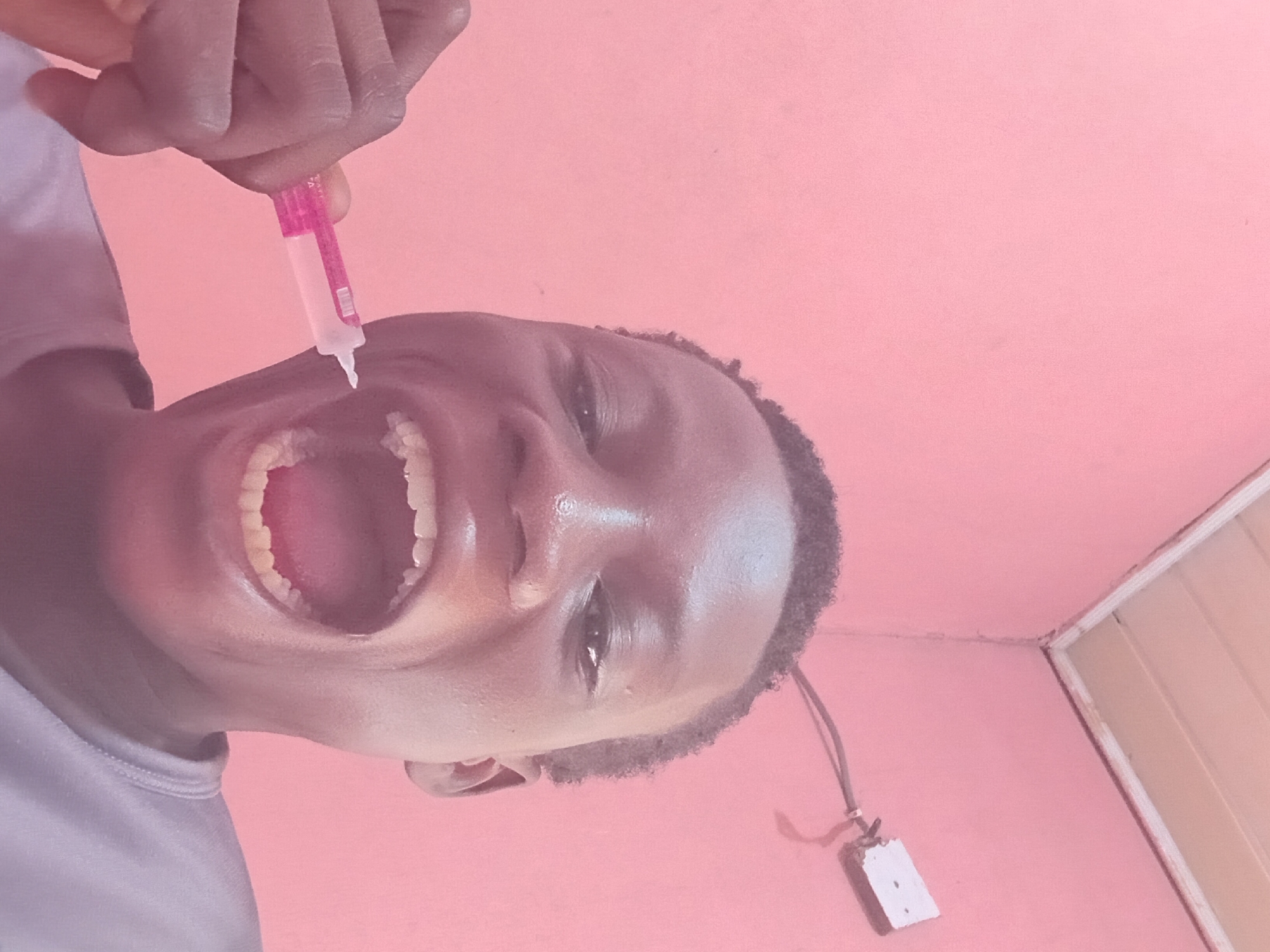 A close-up, medium shot shows a Black male, appearing to be a teenager, with his mouth wide open, about to apply a small pink and white tube, possibly a medicinal cream or toothpaste, to his teeth. The subject's left hand is holding the tube near his mouth. He is wearing a light gray t-shirt. The background is a solid pink wall, with a white ceiling and a white electrical outlet visible in the upper right corner. The lighting suggests an indoor setting, possibly a bedroom or bathroom. The image is taken from a low angle, looking up at the subject.
