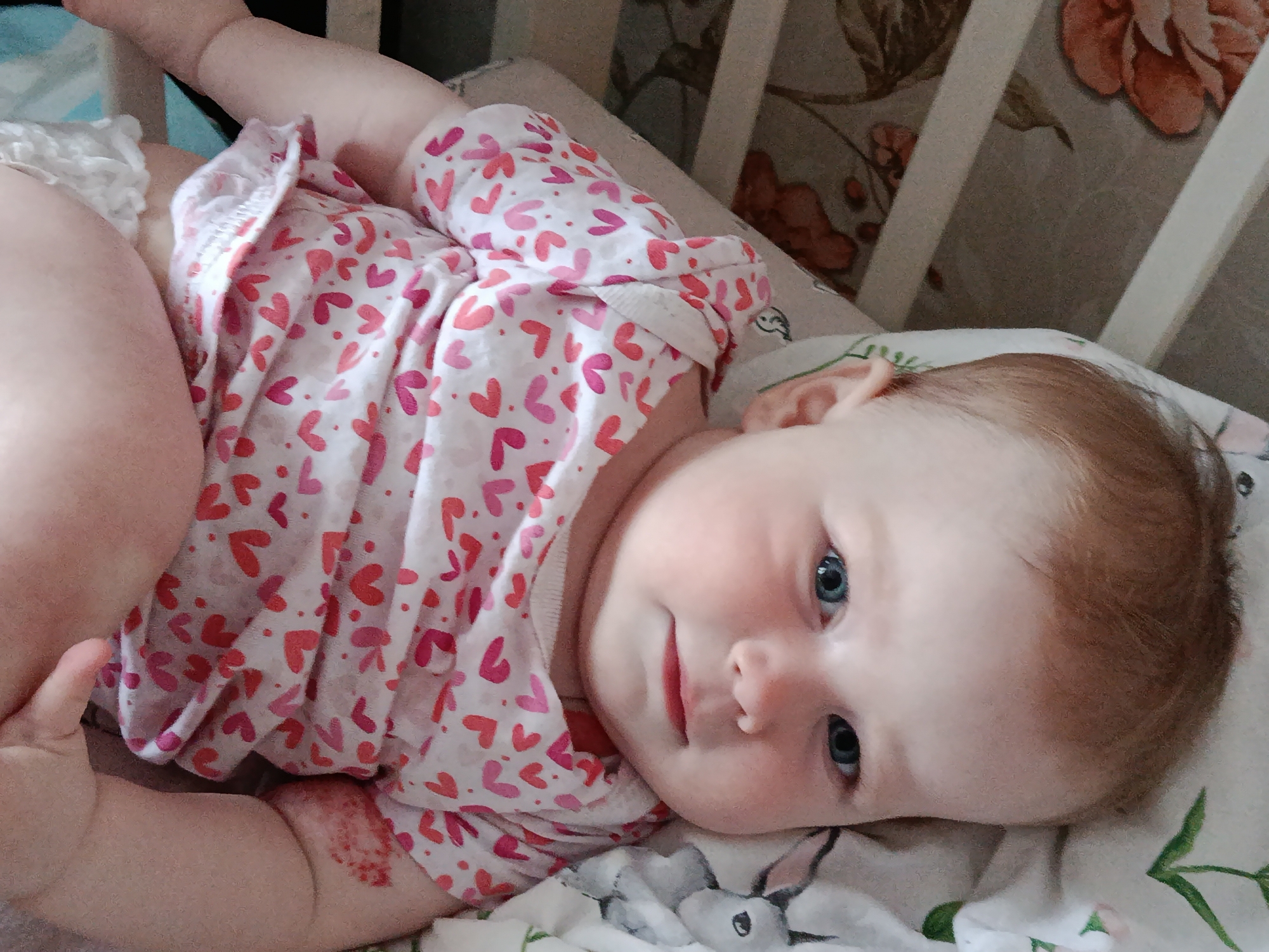 An infant with fair skin, light reddish-blonde hair, and striking blue eyes is depicted lying down, looking towards the viewer. The baby is wearing a white onesie adorned with numerous pink and red heart patterns. A white ruffled diaper or underwear is visible under the onesie.
The baby is situated in what appears to be a crib or bed, indicated by a white wooden frame partially visible on the right and top left of the image. The bedding beneath the baby includes a patterned sheet with what looks like small bunny faces and green leaf designs. In the background, behind the crib, there is wallpaper with large floral patterns in shades of brown and orange.
The infant's expression is calm, with a slight smile or curious gaze directed at the camera. A notable detail is a reddish mark or scratch on the baby's left arm, near the elbow. The scene conveys a peaceful and intimate moment, likely indoors in a home setting such as a nursery or bedroom. There is no visible text in the image.