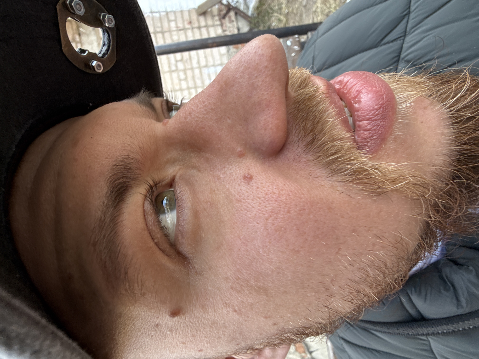 A close-up, upward-angled profile shot of a person's face with a beard and mustache. The person is wearing a dark-colored baseball cap with a metallic bottle opener attached. The person's eye is visible, showing light-colored iris. The person's mouth is slightly open. The person appears to be wearing a gray, puffy coat. The background is blurred, showing a glimpse of an outdoor setting with a gray fence and a building or other structure with light-colored siding. There is no evidence to indicate the location is the city of Borzya, Russia.