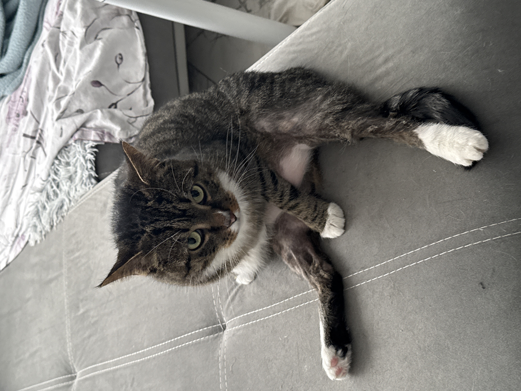 A tabby cat with brown-grey fur and black stripes is lying on a grey upholstered sofa, looking directly at the camera. The cat has a white chest, white paws, and white fur around its mouth and nose. Its eyes are a striking greenish-yellow. The cat is positioned on its side, with its front paws tucked in and one hind leg extended. Notably, there are patches of thin or missing fur on the cat's belly and hind legs, suggesting a recent medical procedure or hair loss.
The sofa features a tufted design with prominent white stitching that creates a grid pattern. In the background, to the upper left, a light-colored blanket or cloth with a subtle pattern, possibly floral or abstract in purple hues, is visible, draped over what appears to be another piece of furniture or an armrest. Another light-colored surface is partially seen in the top-middle background. The lighting suggests daytime. The cat's expression appears calm and curious. While not visible in the image itself, the location context provided is Burgas, Bulgaria. There is no visible text in the image.