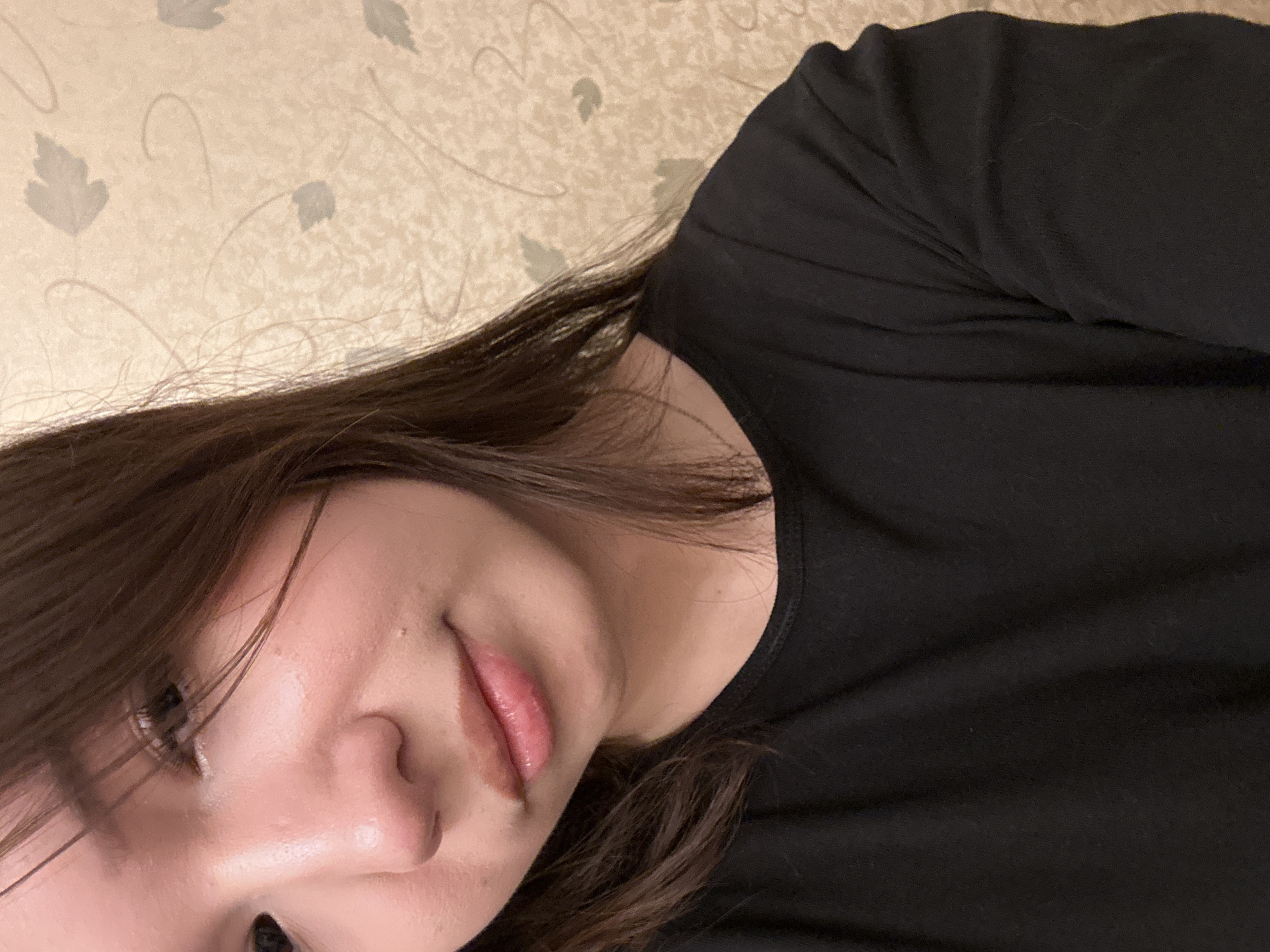 The image features a young woman, visible from the chest up, with her head angled slightly towards the viewer. She has long, dark brown hair that partially covers the left side of her face and forehead. Her right eye is dark and partially obscured by her hair. Her skin appears fair with some areas of redness, particularly around her nose. A small, light-colored blemish or mole is present on her right cheek below the eye, and another near the corner of her mouth on the chin area. Her lips are full, slightly parted, and exhibit a pinkish hue with a reflective highlight on the lower lip. A small white mark or residue is visible on her upper lip, just below the philtrum. She is wearing a plain black crew-neck long-sleeved shirt. The background consists of a light beige or cream-colored wallpaper patterned with subtle grey-green stylized leaves and thin, looping lines. The lighting appears to be an indoor artificial source. There are no identifiable features within the image that confirm the specific location as Naberezhnye Chelny, Russia.