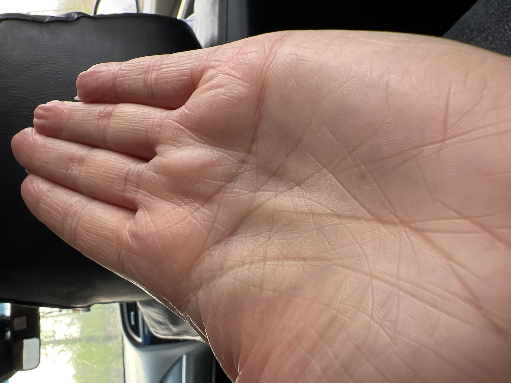 A close-up photograph shows the palm of a fair-skinned human hand. The hand is open with fingers slightly separated. The skin exhibits numerous lines and wrinkles characteristic of a human palm. The background is blurred, but elements suggest the interior of a vehicle. Parts of a black headrest and rearview mirror are visible, along with a glimpse of green vegetation through the windshield. The location is unknown.