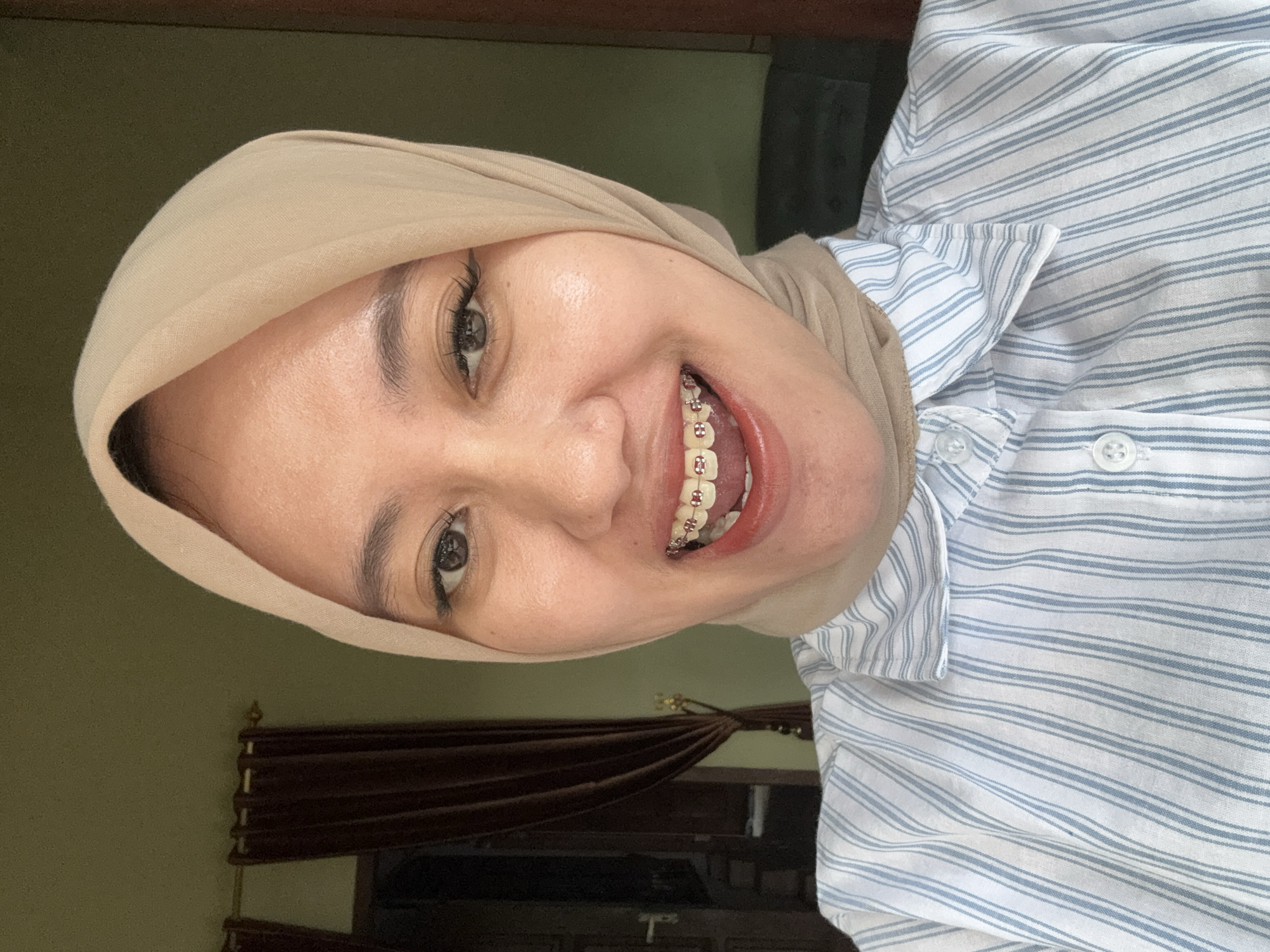 A woman wearing a beige hijab and a blue and white striped shirt is smiling at the camera, revealing braces on her teeth. The photo appears to be taken indoors, with a dark brown curtain visible in the background. The location is Gadingrejo, Indonesia.