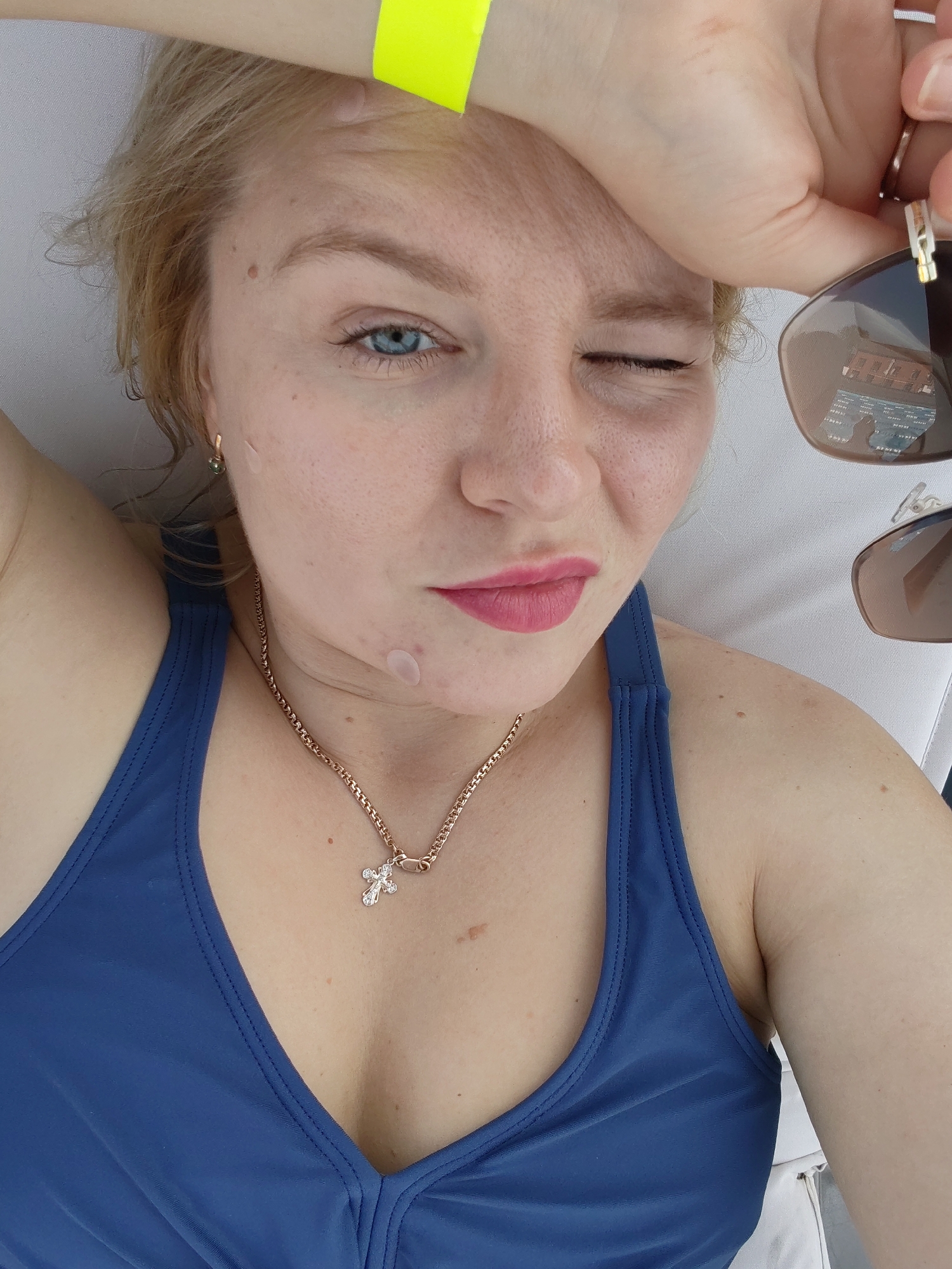 In Pirogovo, Russia, a woman with blonde hair and blue eyes, wearing a blue swimsuit and a gold cross necklace, winks at the camera. She is holding sunglasses in her right hand, obscuring her forehead with her left arm. Two clear circular bandages are visible on her face. The background is a white, textured surface.