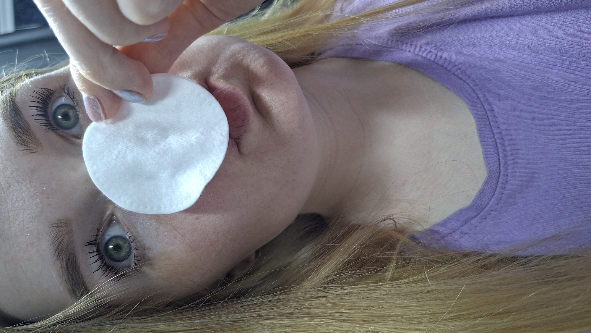 A woman with fair skin and blonde hair is lying down, wearing a purple top. She has green eyes and visible freckles. Her hand is holding a white cotton pad over her mouth. The location is unknown; there is no information indicating the city of Chaikovsky, Russia.