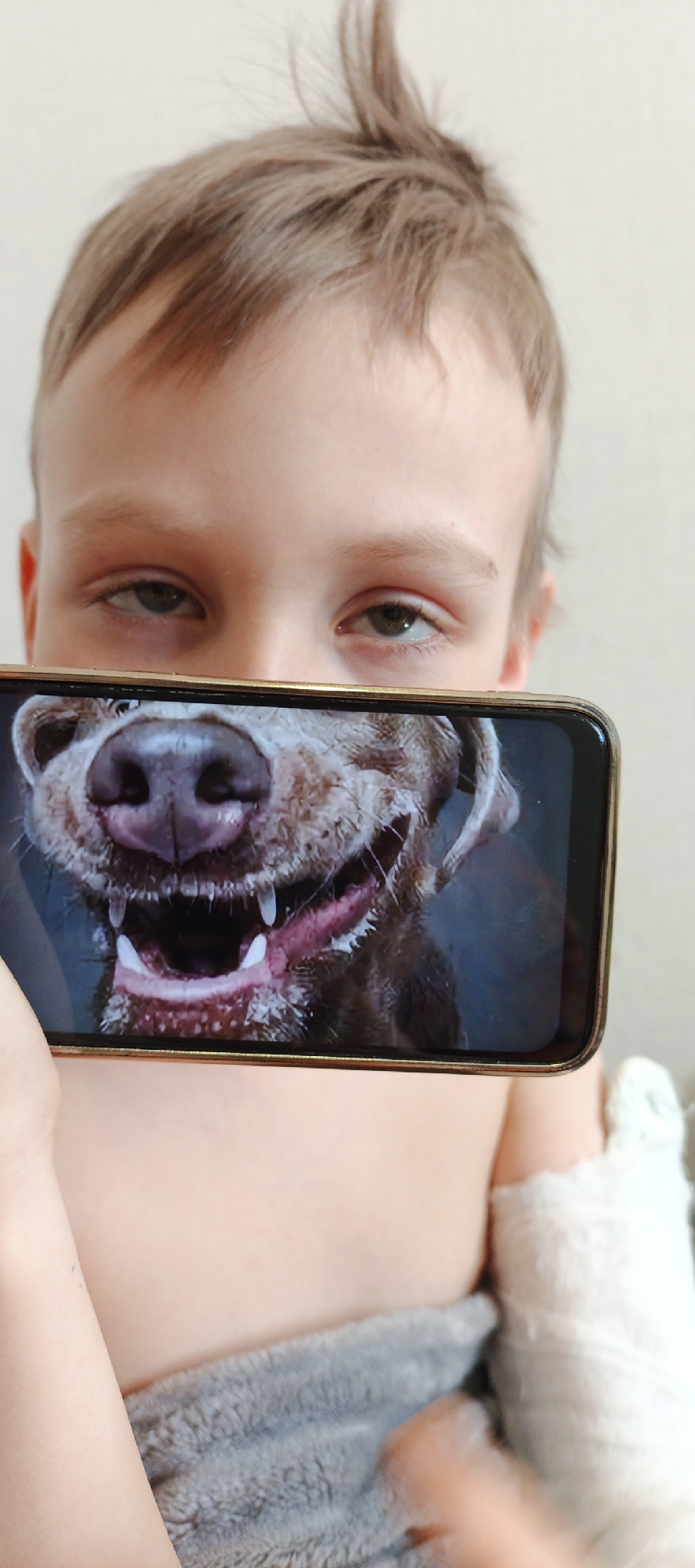 A fair-skinned boy with light brown hair, some of which is sticking up, is holding a cell phone in front of his face. The phone displays an image of a dog's nose and mouth, filling the space where the boy's mouth and nose would be. The boy's eyes are visible above the phone. The boy's arm with a white cast is visible on the right side of the image and a gray blanket is around his shoulder. The background is a plain, light-colored wall. The location is unknown, but mentioned as the city of Chaikovsky, Russia.