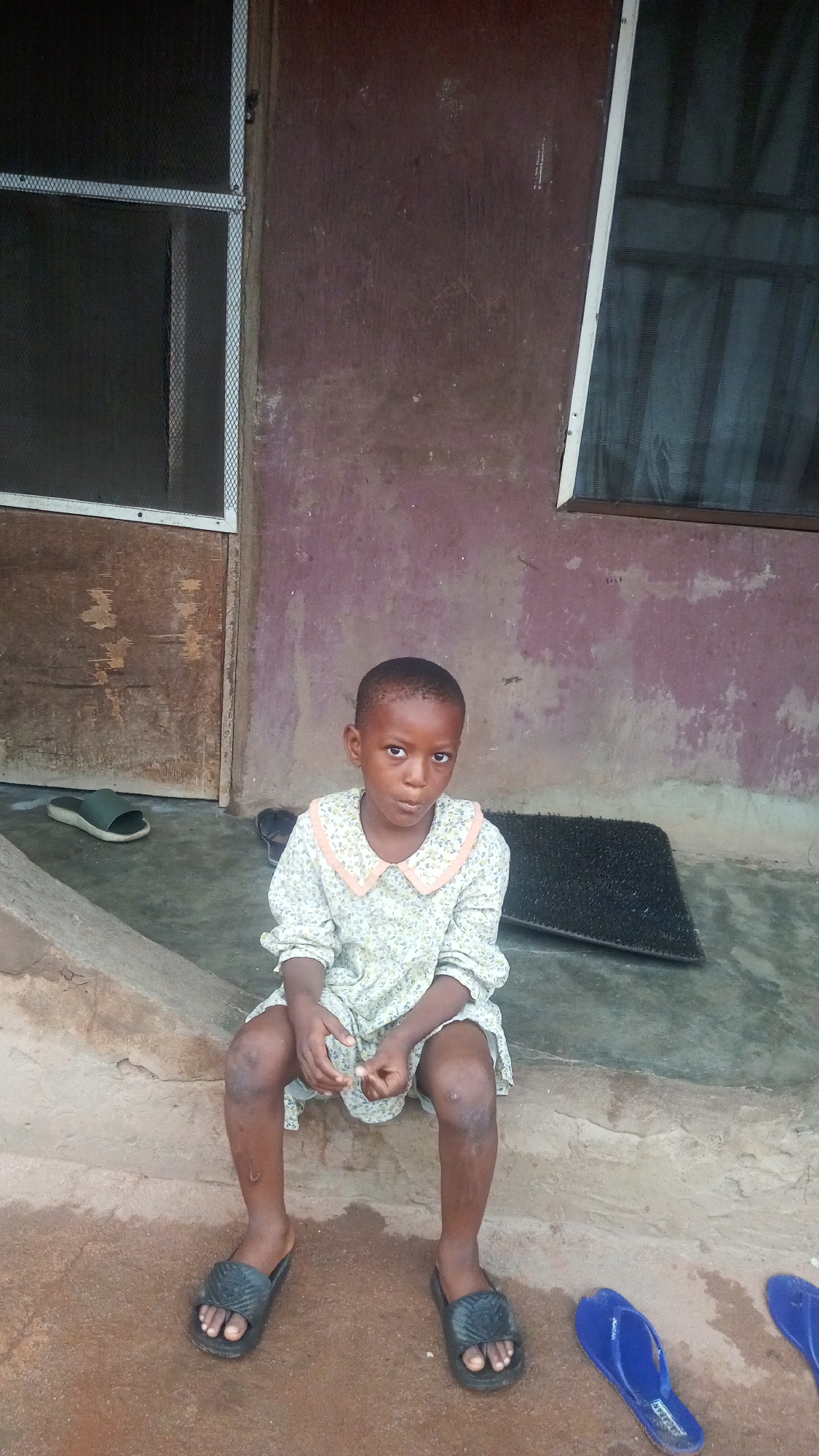 A young girl sits on a concrete step outside a building in what is presumed to be Onitsha, Nigeria. The building behind her is painted in maroon and pale purple, with two windows, one of which appears to have a security screen. To the left of the girl, a pair of green and black sandals sits beside the steps. A doormat lies between the girl and one of the windows. The girl wears a floral dress with a pink collar and black slides. A pair of blue flip-flops are present near her feet. The girl is looking directly at the camera.